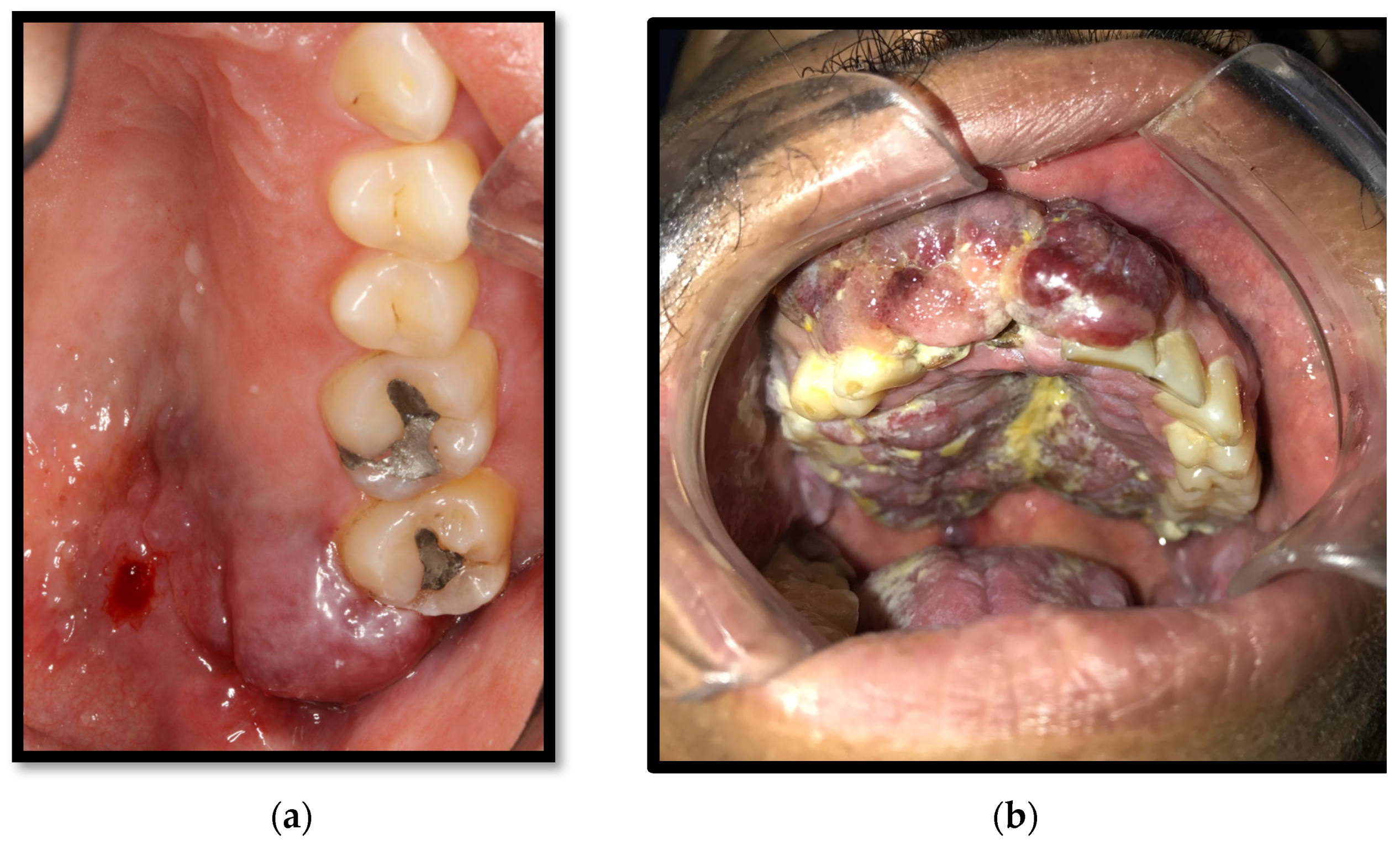 Medicina 58 01214 g008