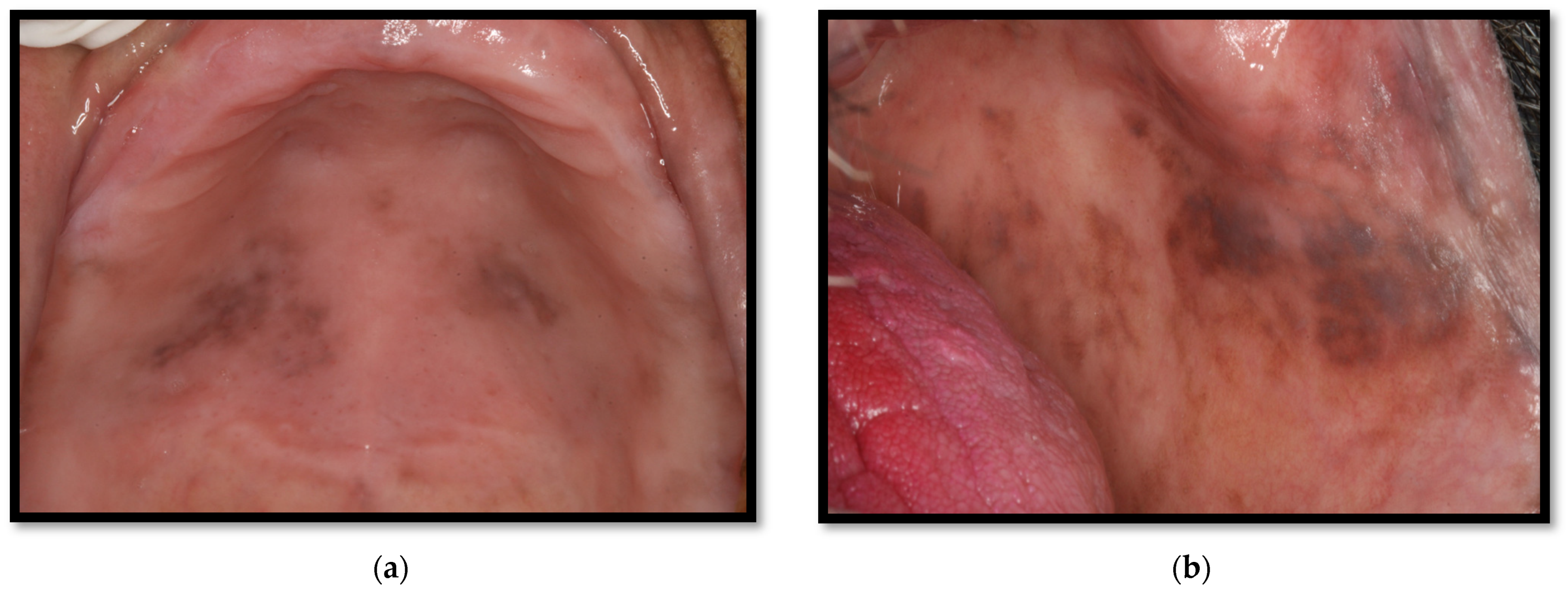 Medicina 58 01214 g012