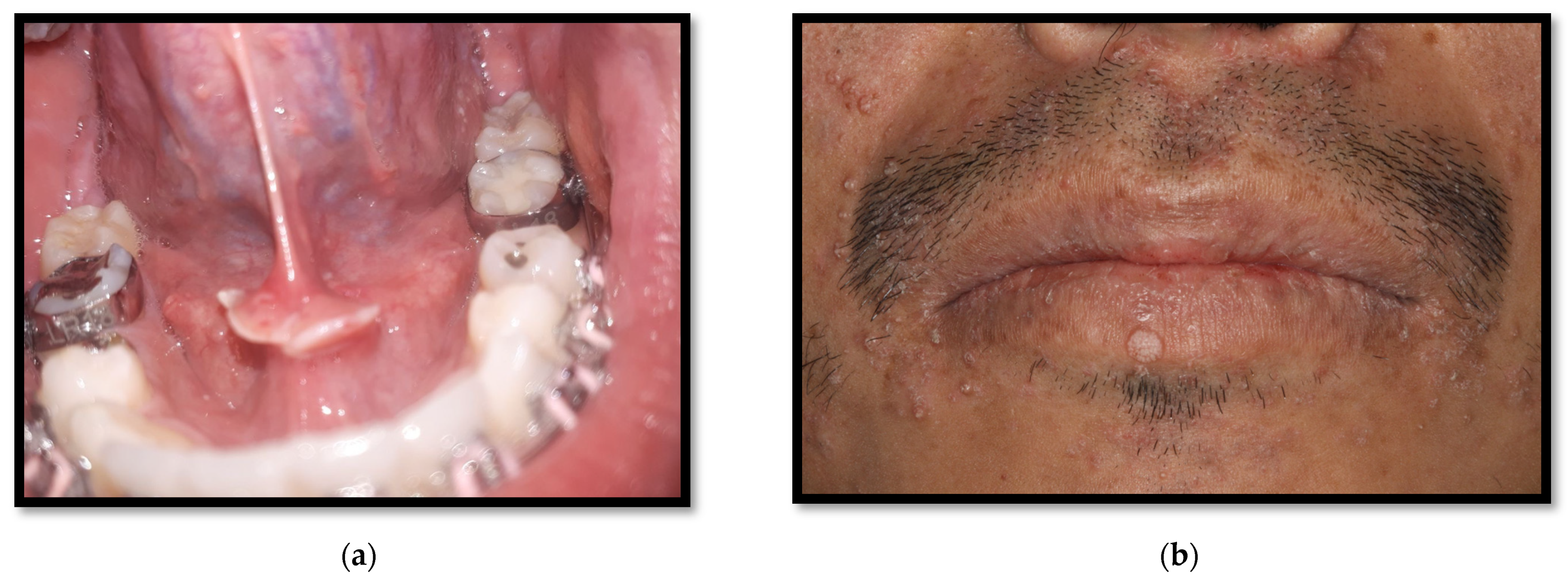 Medicina 58 01214 g014