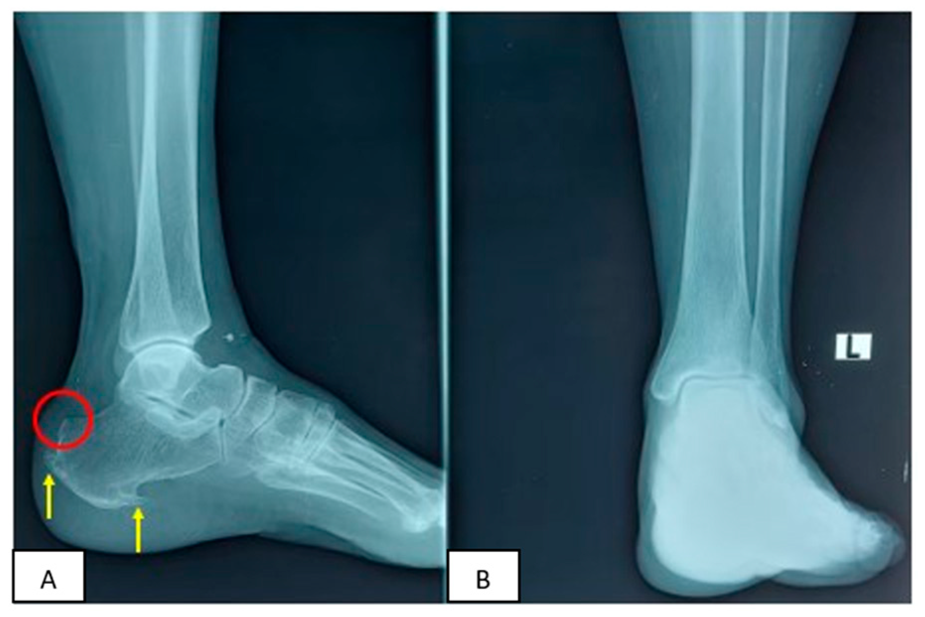 Medicina 58 01216 g002 550