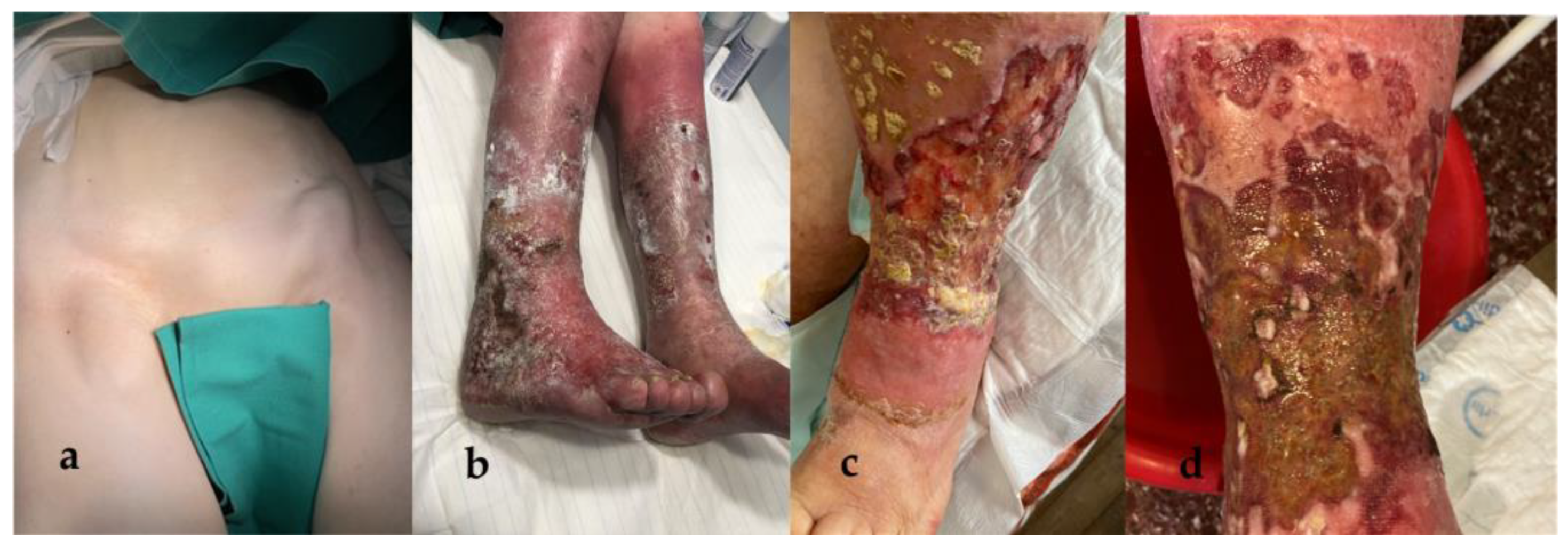 Medicina 58 01222 g001 550