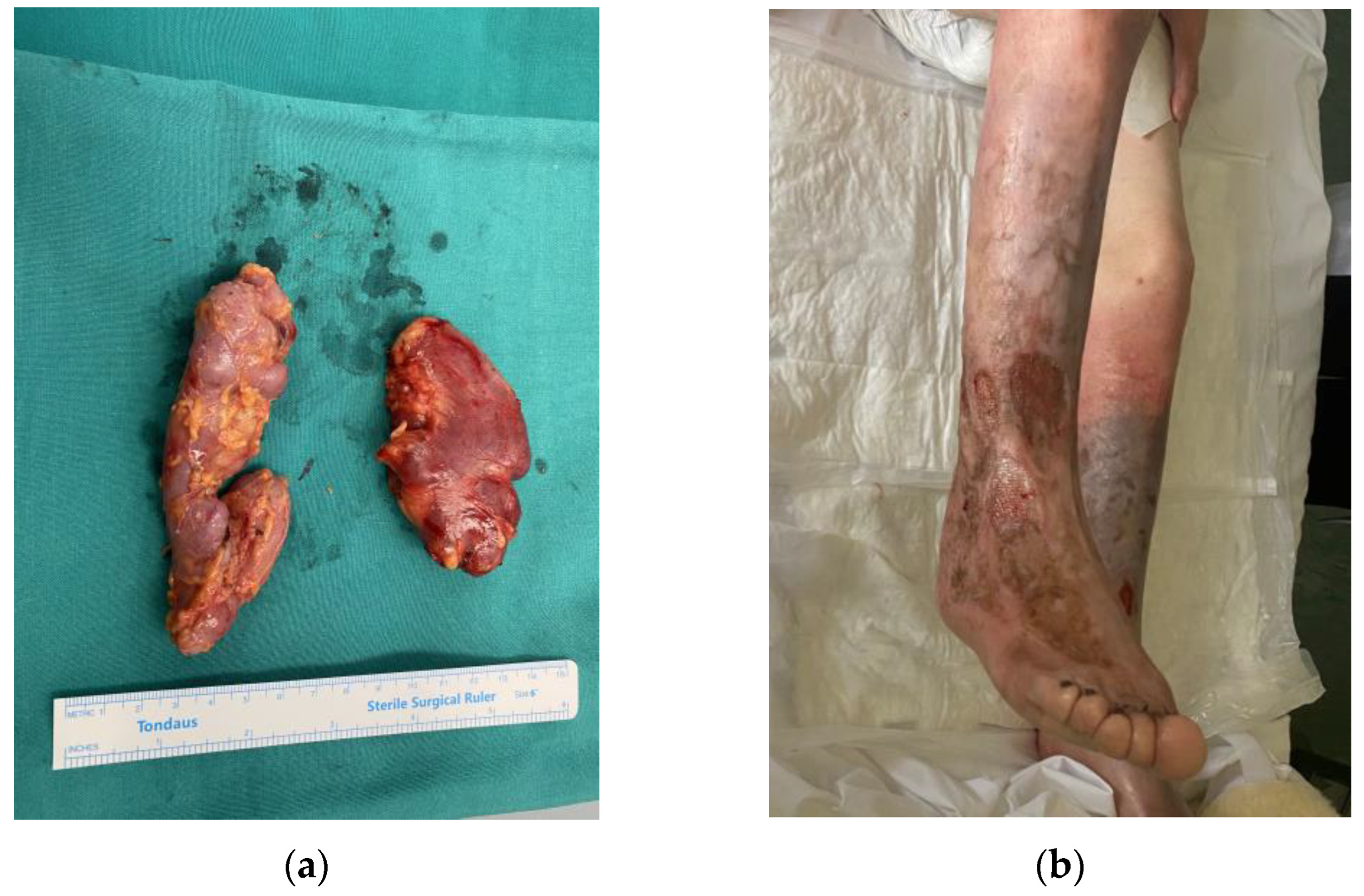 Medicina 58 01222 g002 550