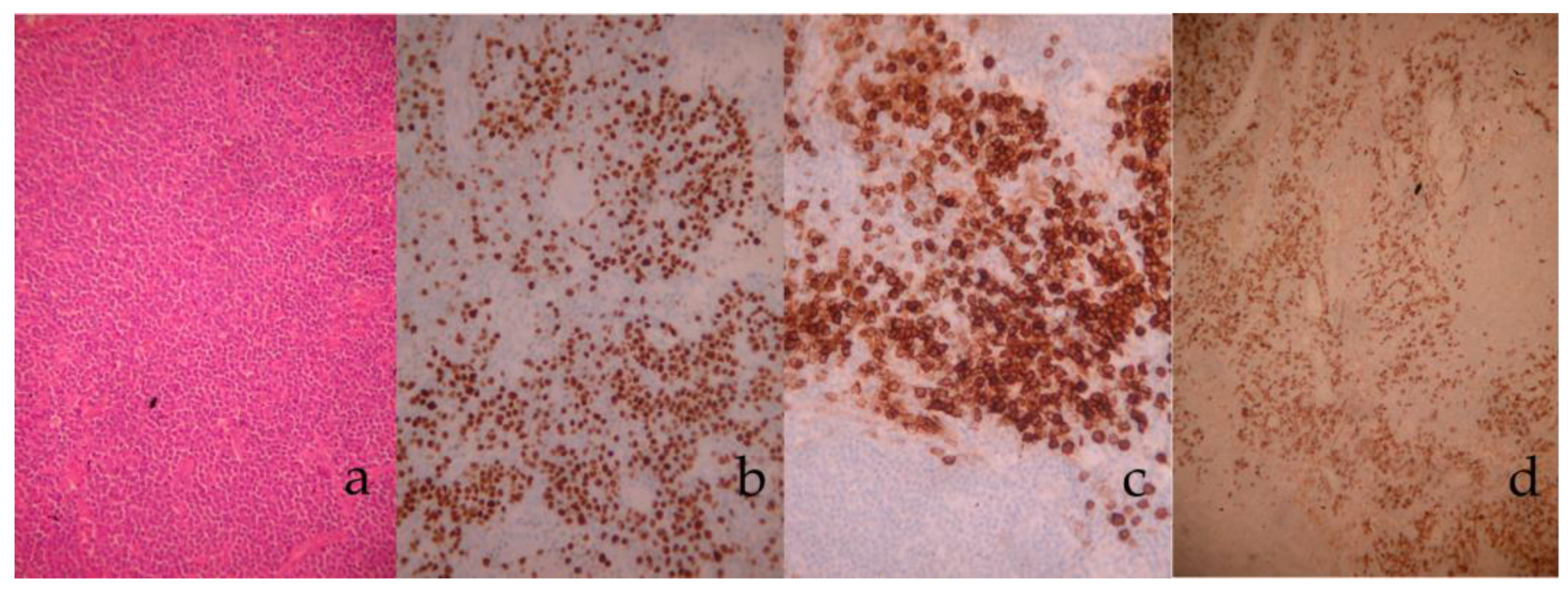 Medicina 58 01222 g003 550