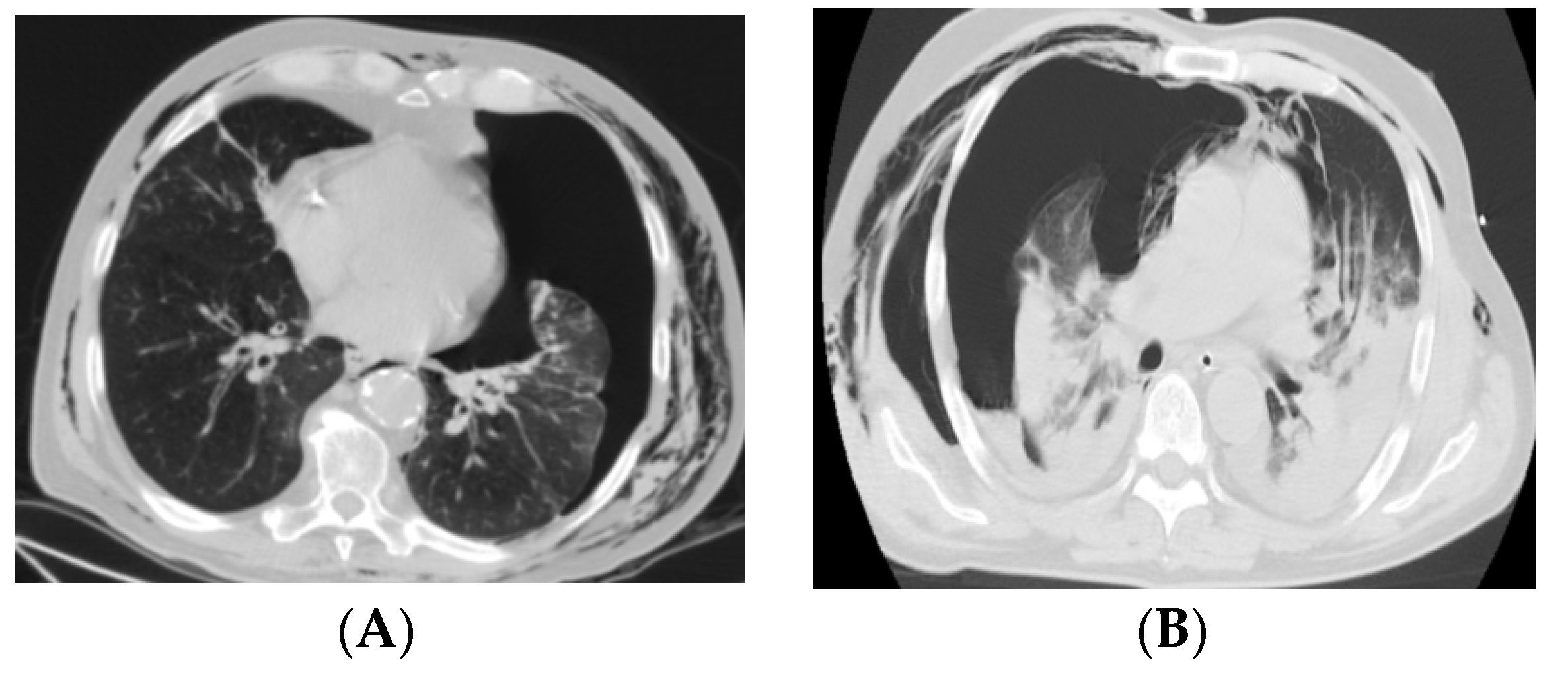 Medicina 58 01242 g001