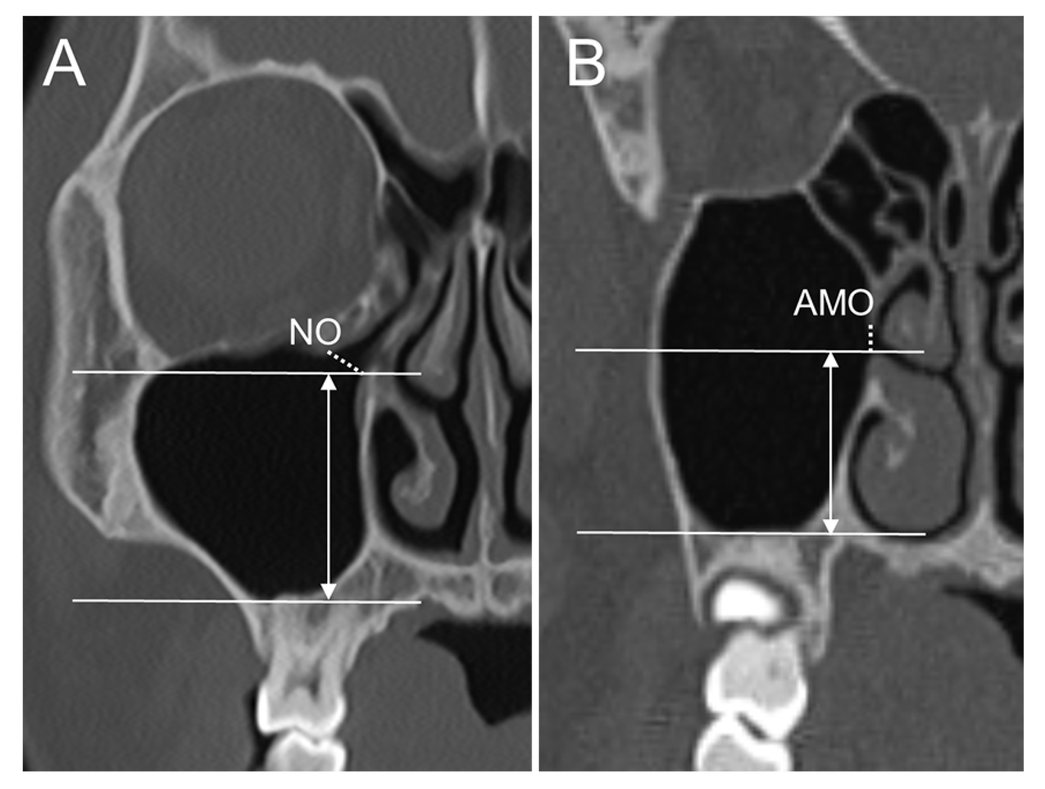 Medicina 58 01243 g003 550