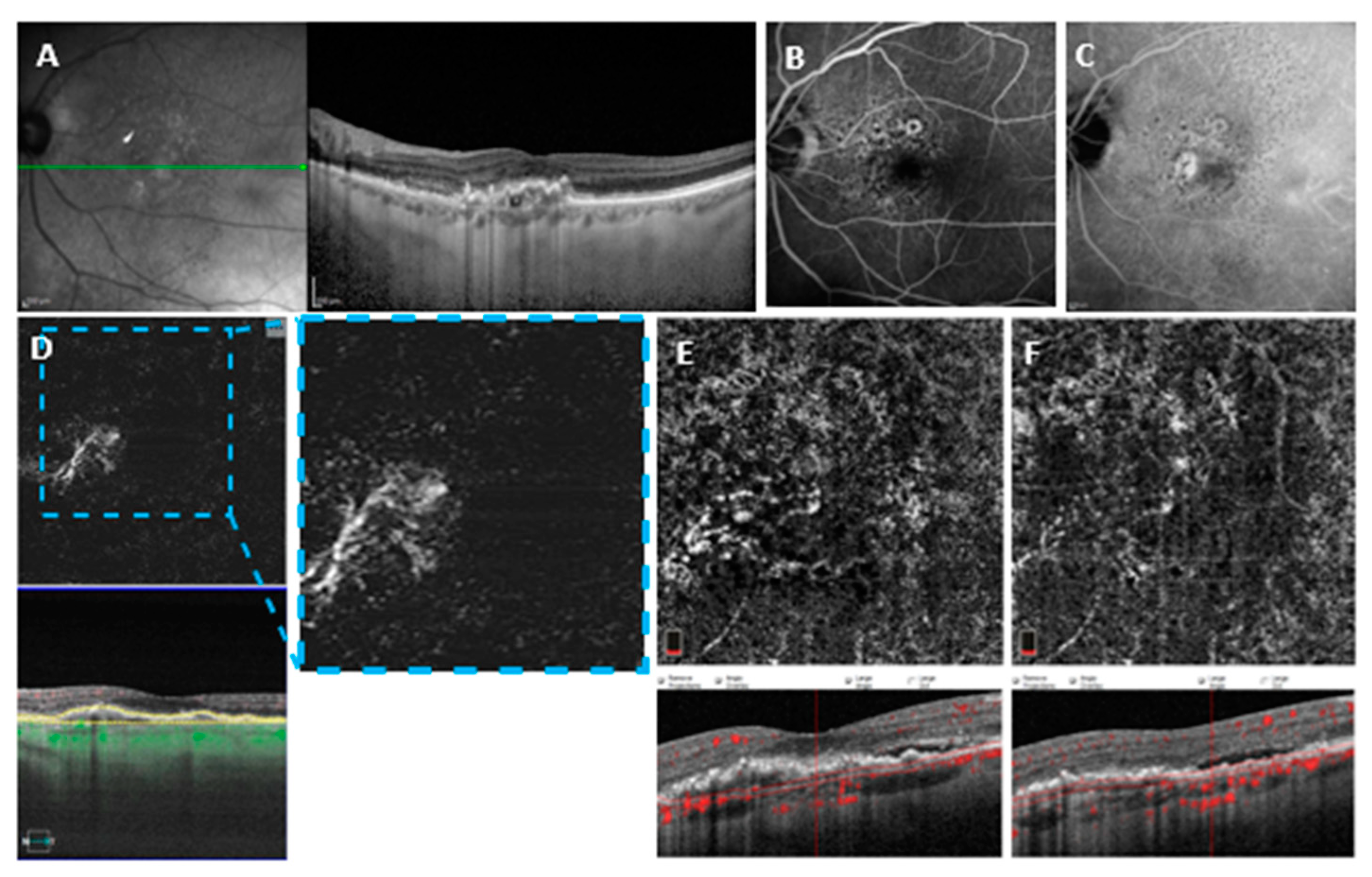 Medicina 58 01246 g003 550