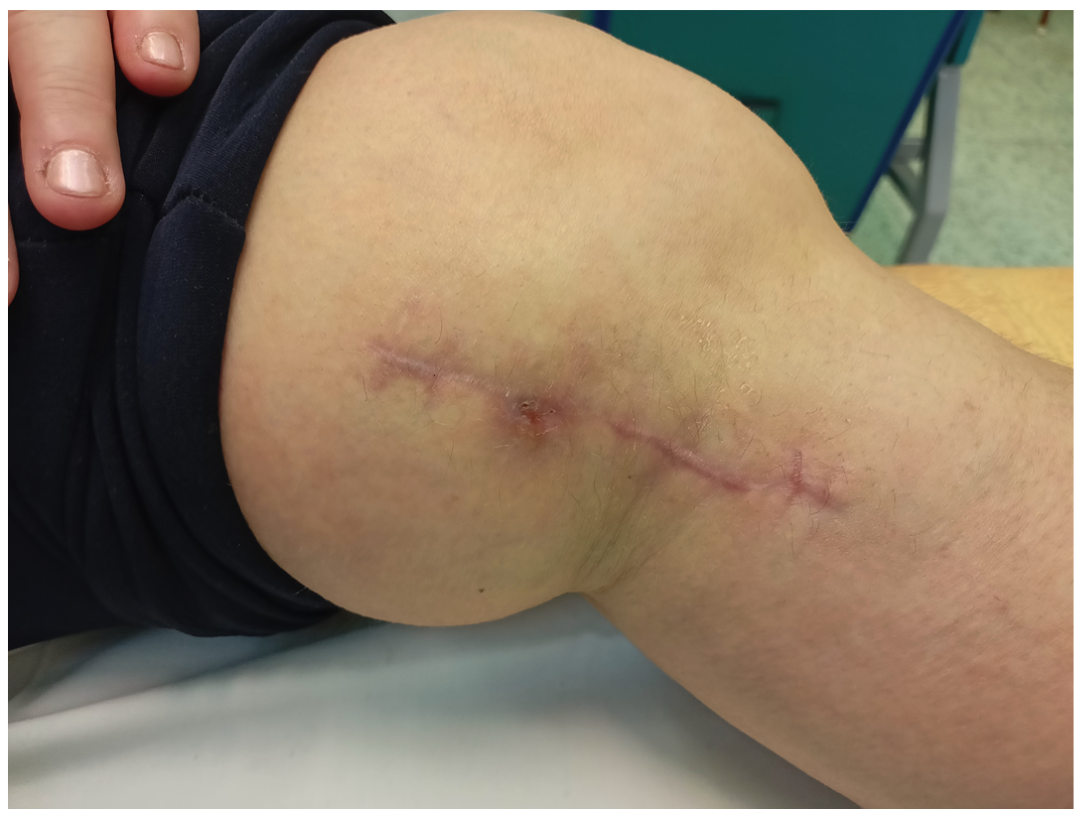 Medicina 58 01259 g004