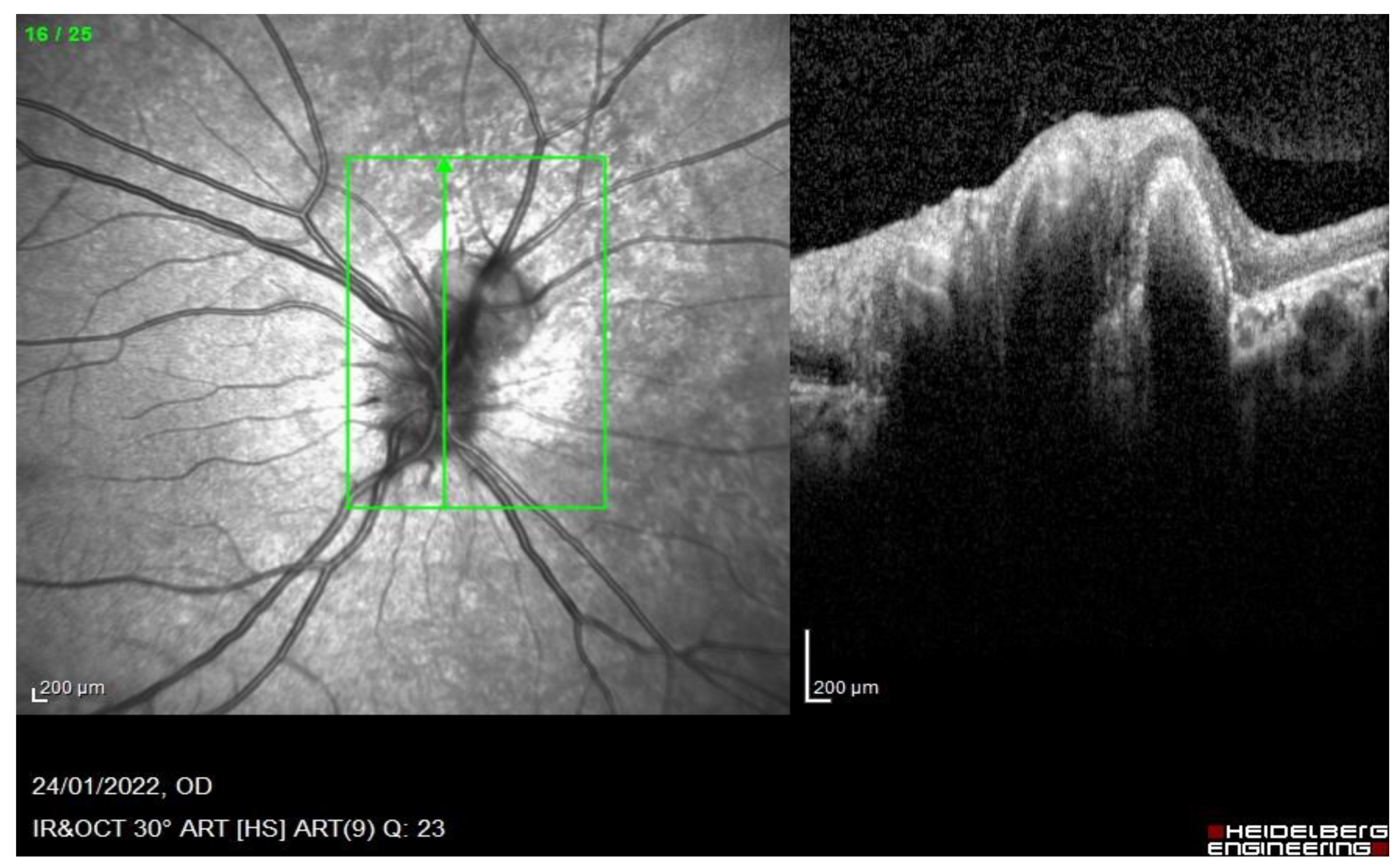Medicina 58 01260 g003b 550