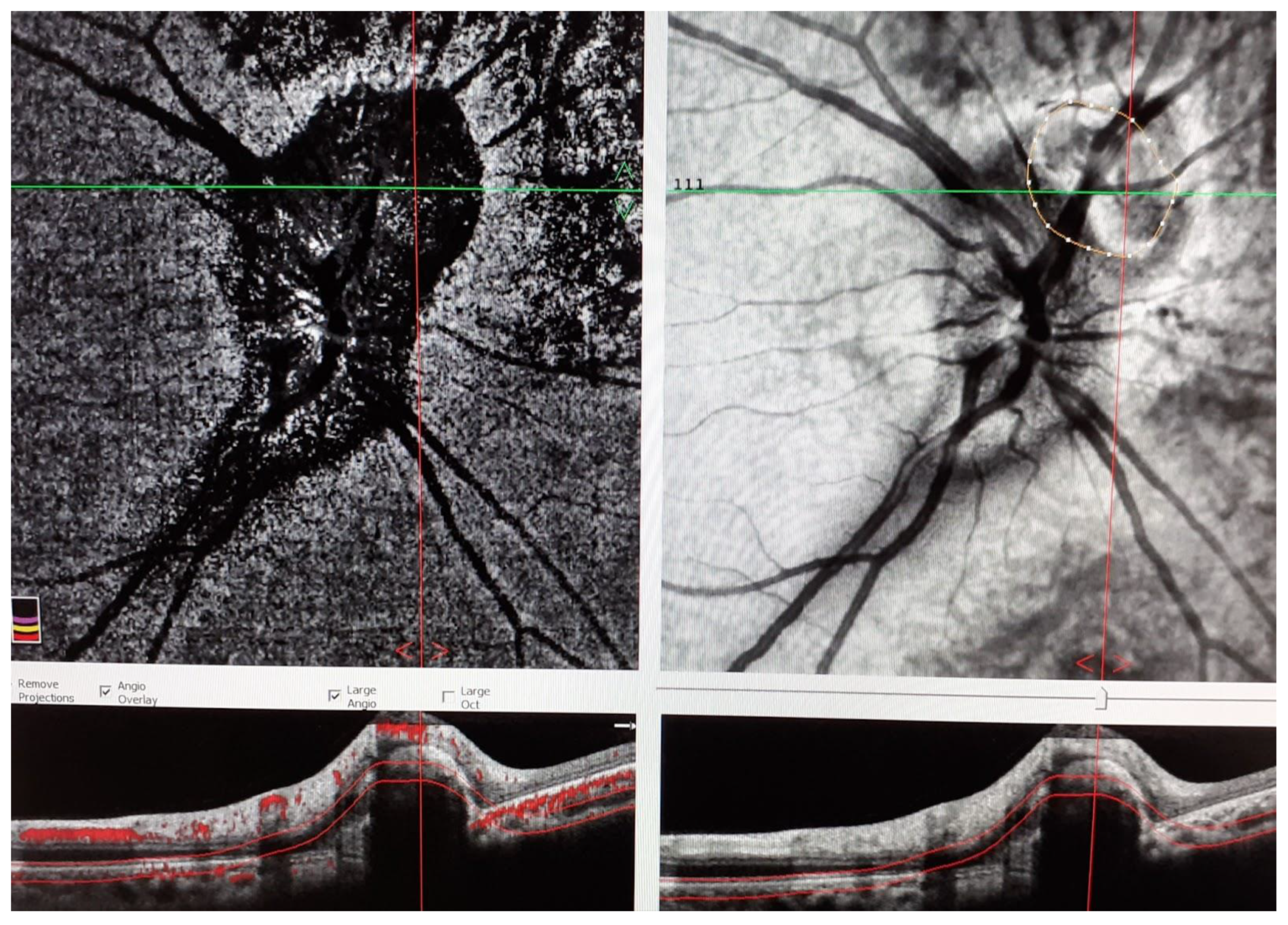 Medicina 58 01260 g004b 550