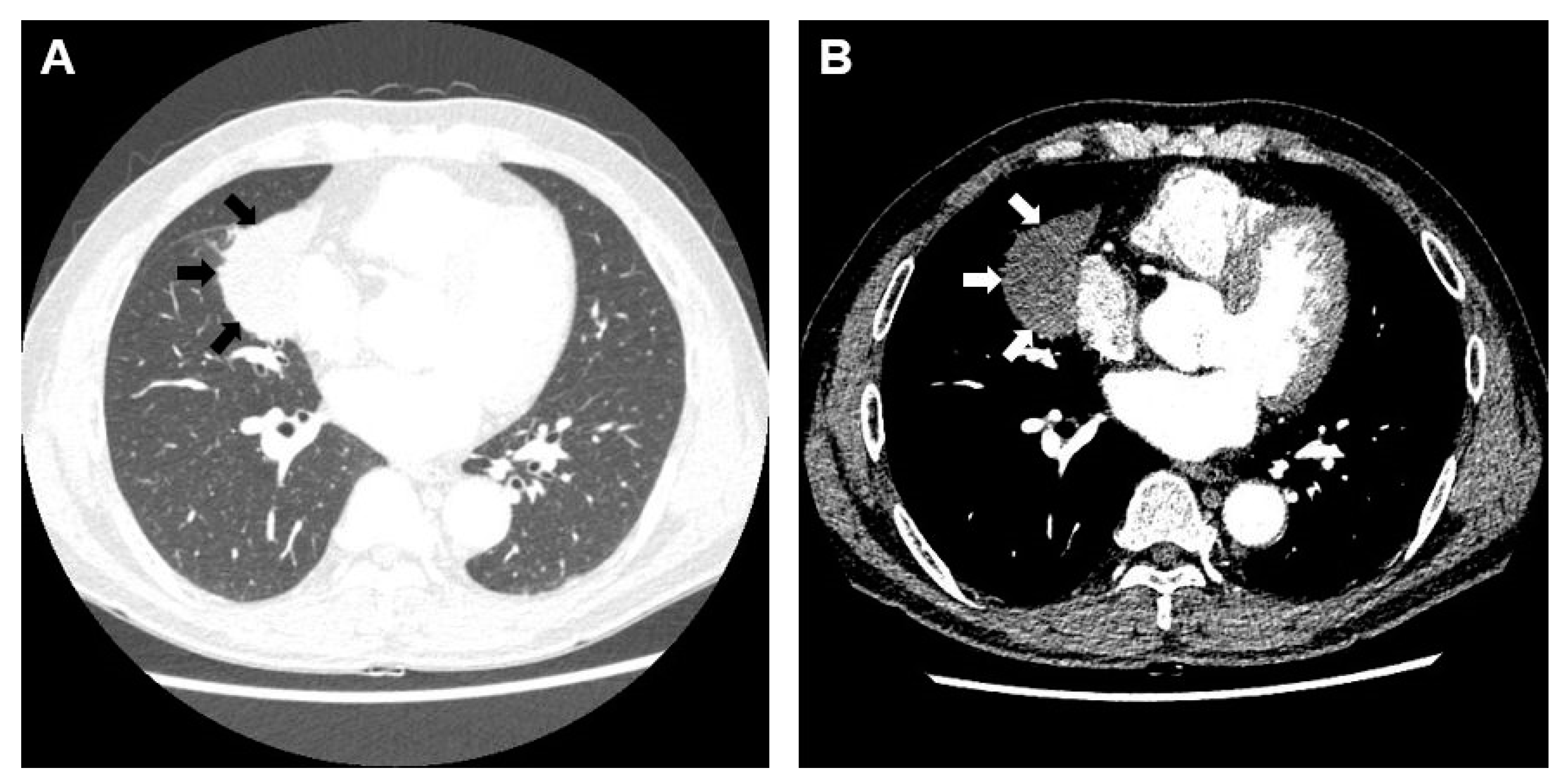 Medicina 58 01275 g001 550