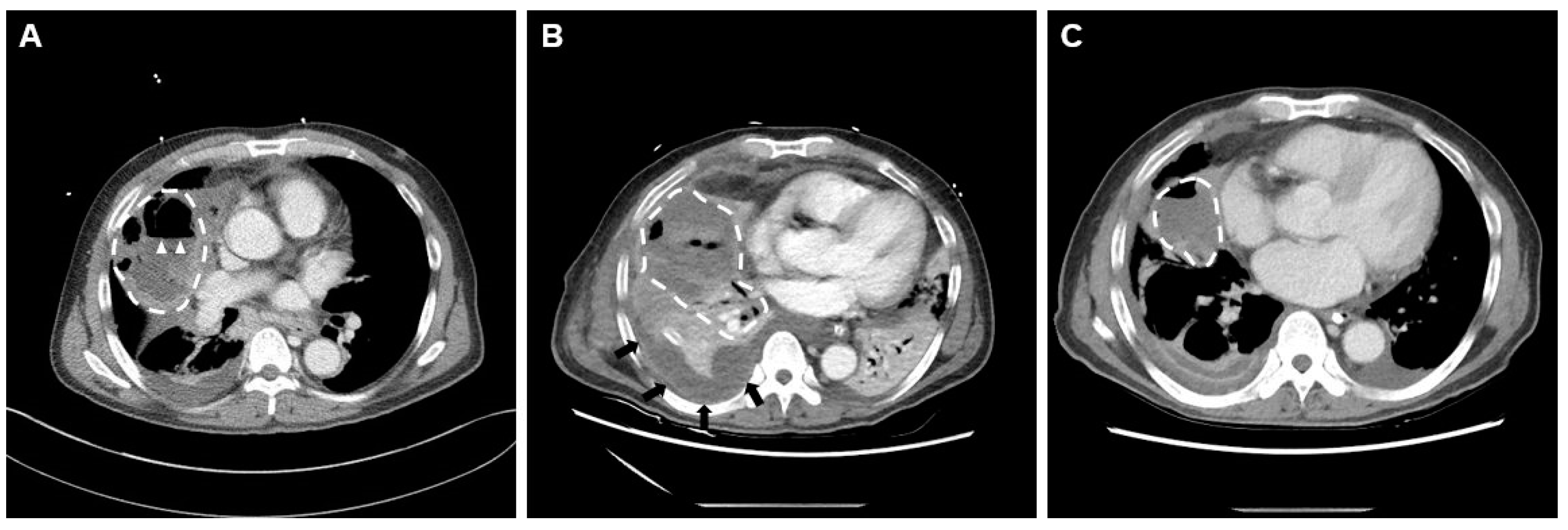 Medicina 58 01275 g002 550