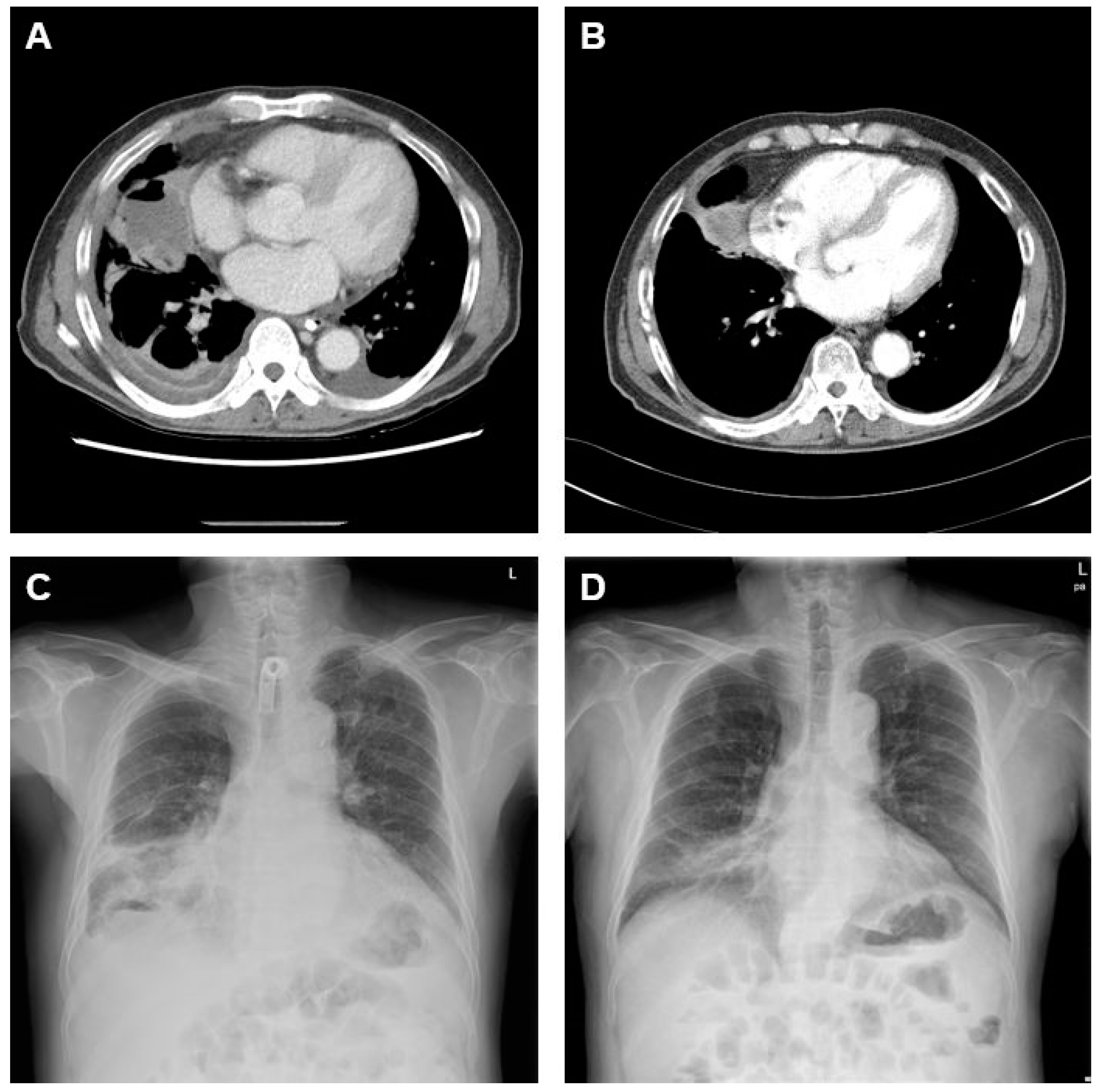 Medicina 58 01275 g003 550