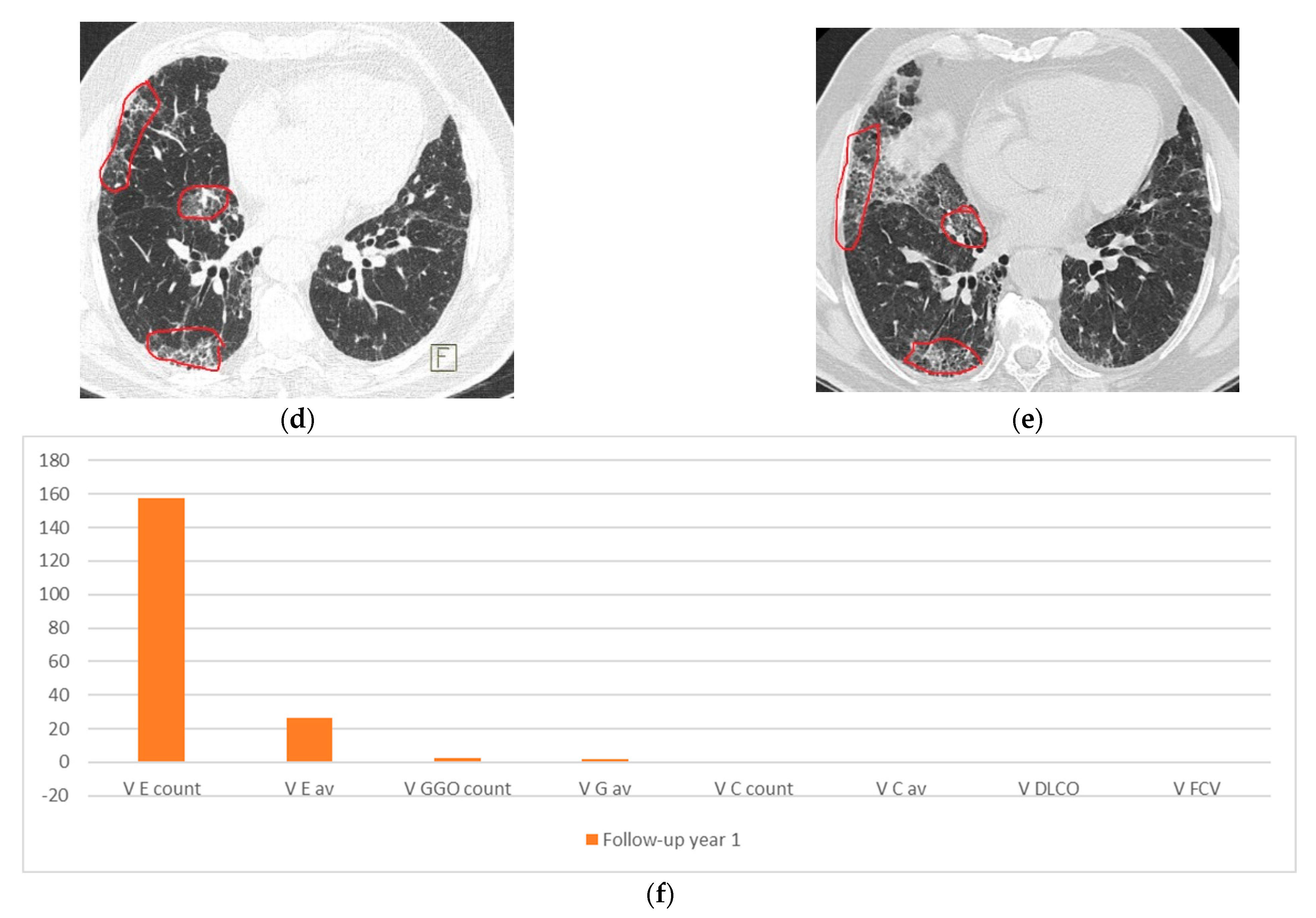 Medicina 58 01288 g003b Medicina 58 01288 g003b