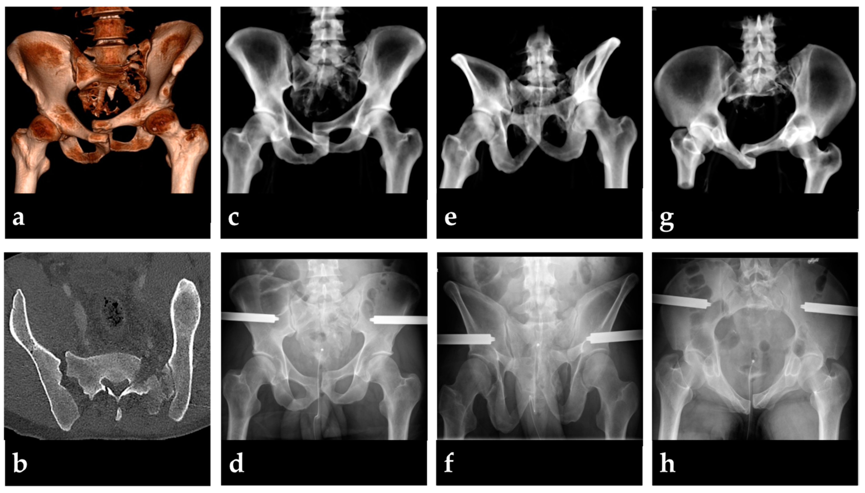 Medicina 58 01291 g001 Medicina 58 01291 g001