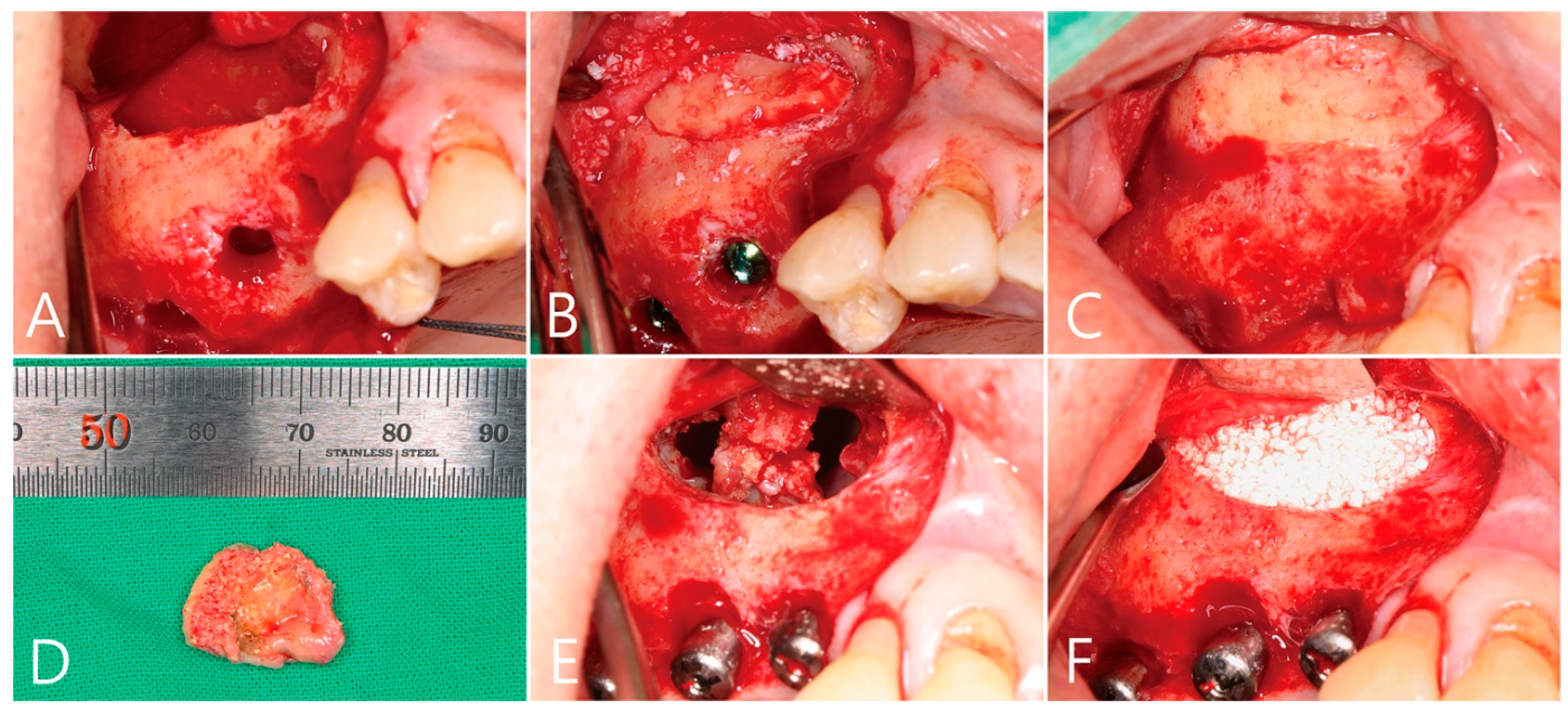 Medicina 58 01300 g005 550