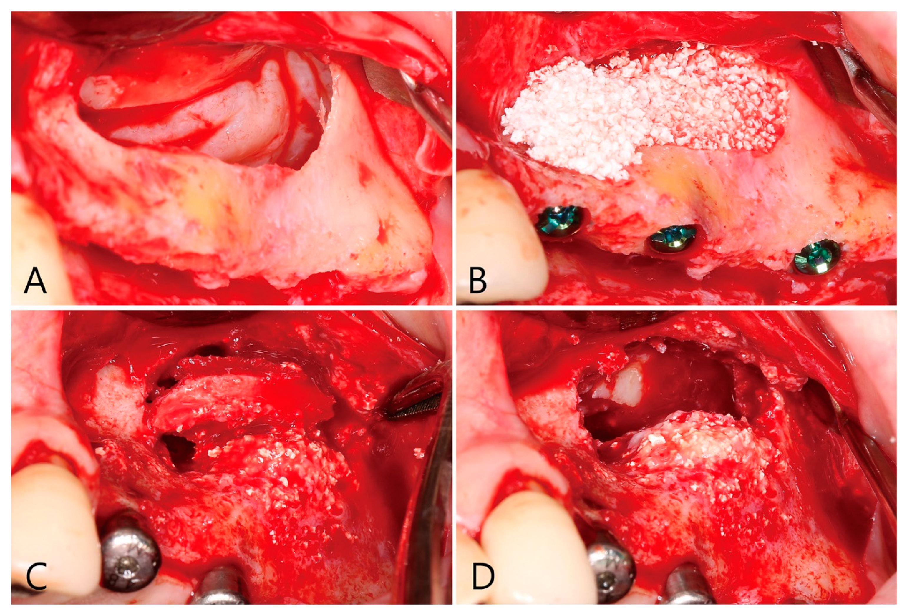 Medicina 58 01300 g011 550