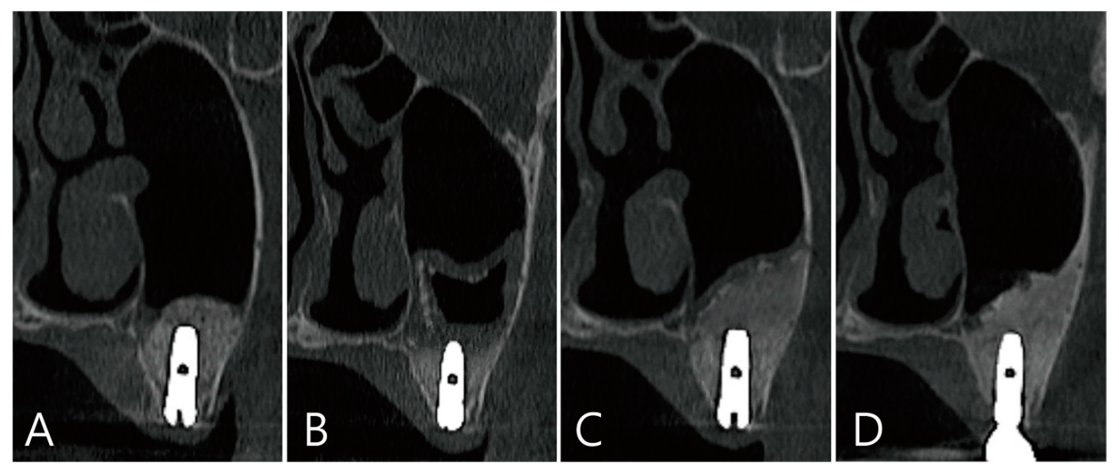 Medicina 58 01300 g013 550