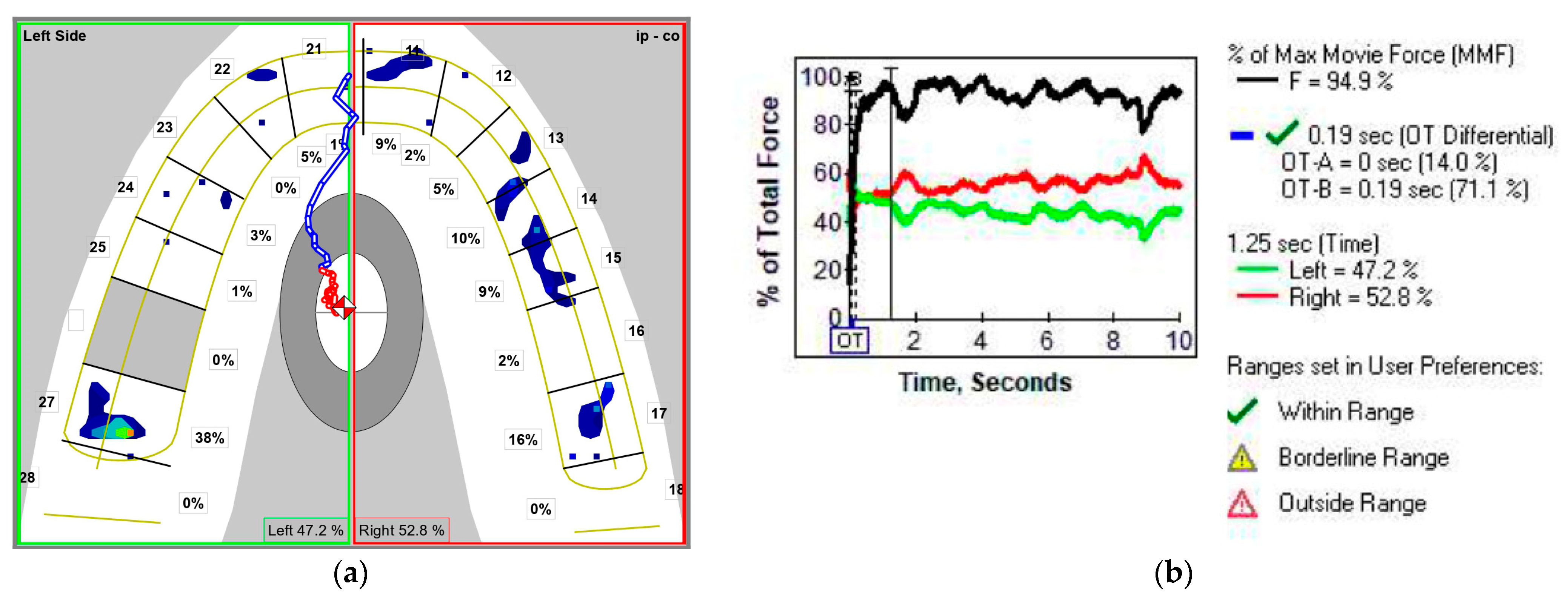 Medicina 58 01303 g005 550
