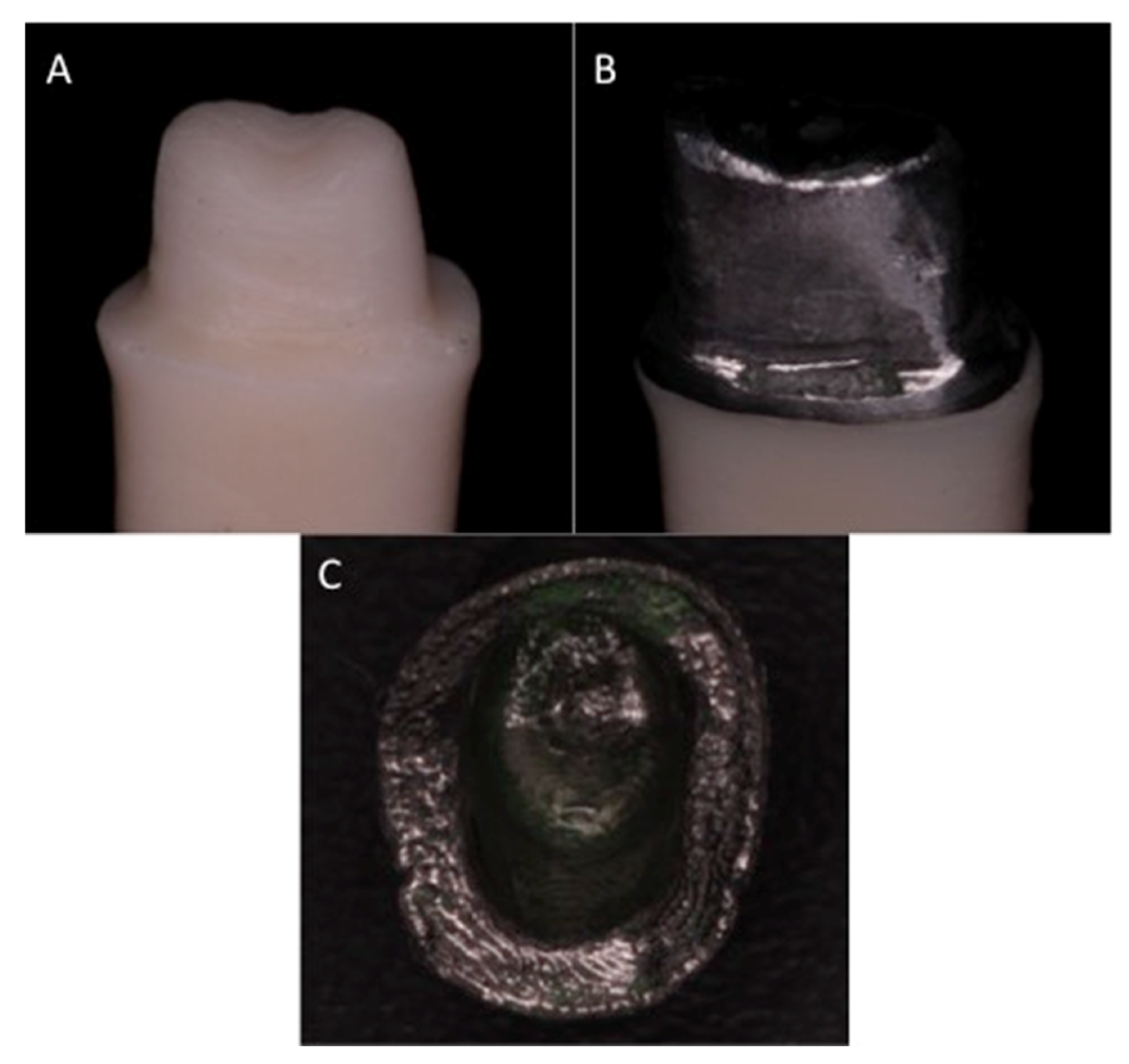 Medicina Free FullText Marginal Misfit of 3DPrinted (Selective