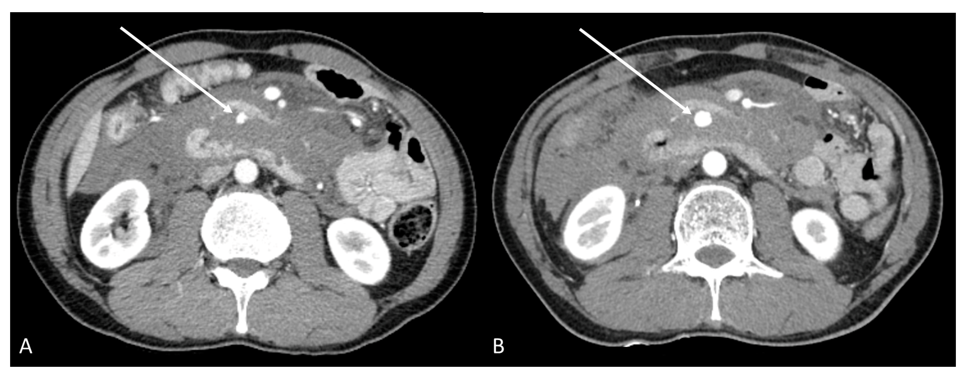 Medicina 58 01320 g001 550