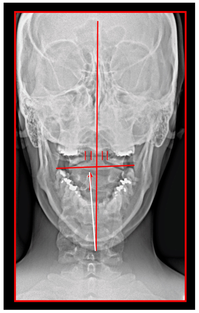 Medicina 58 01324 g004