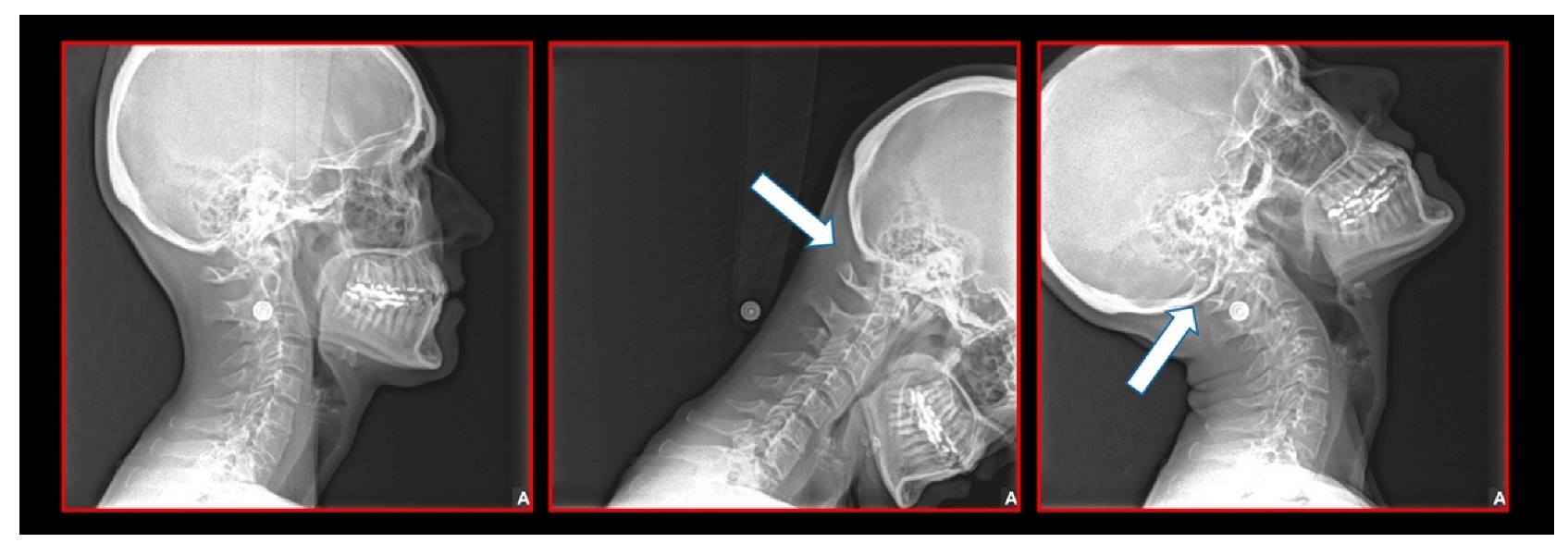 Medicina 58 01324 g007