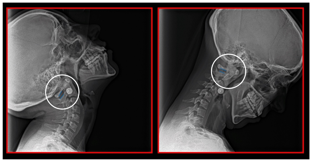 Medicina 58 01324 g013