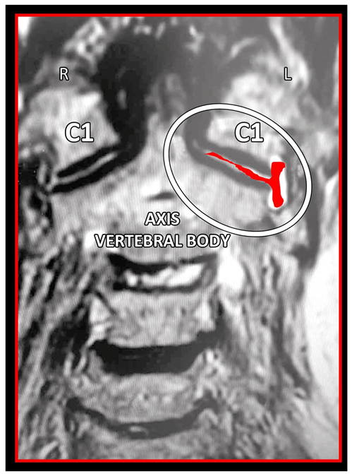 Medicina 58 01324 g018