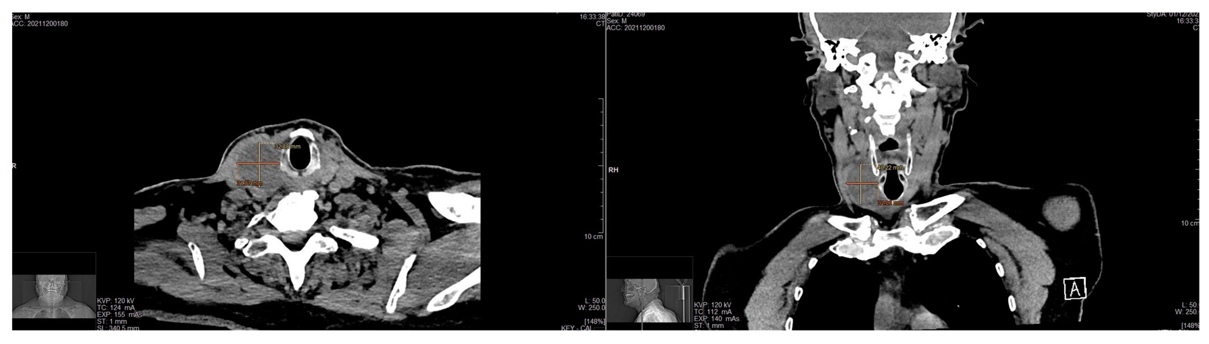 Medicina 58 01345 g002
