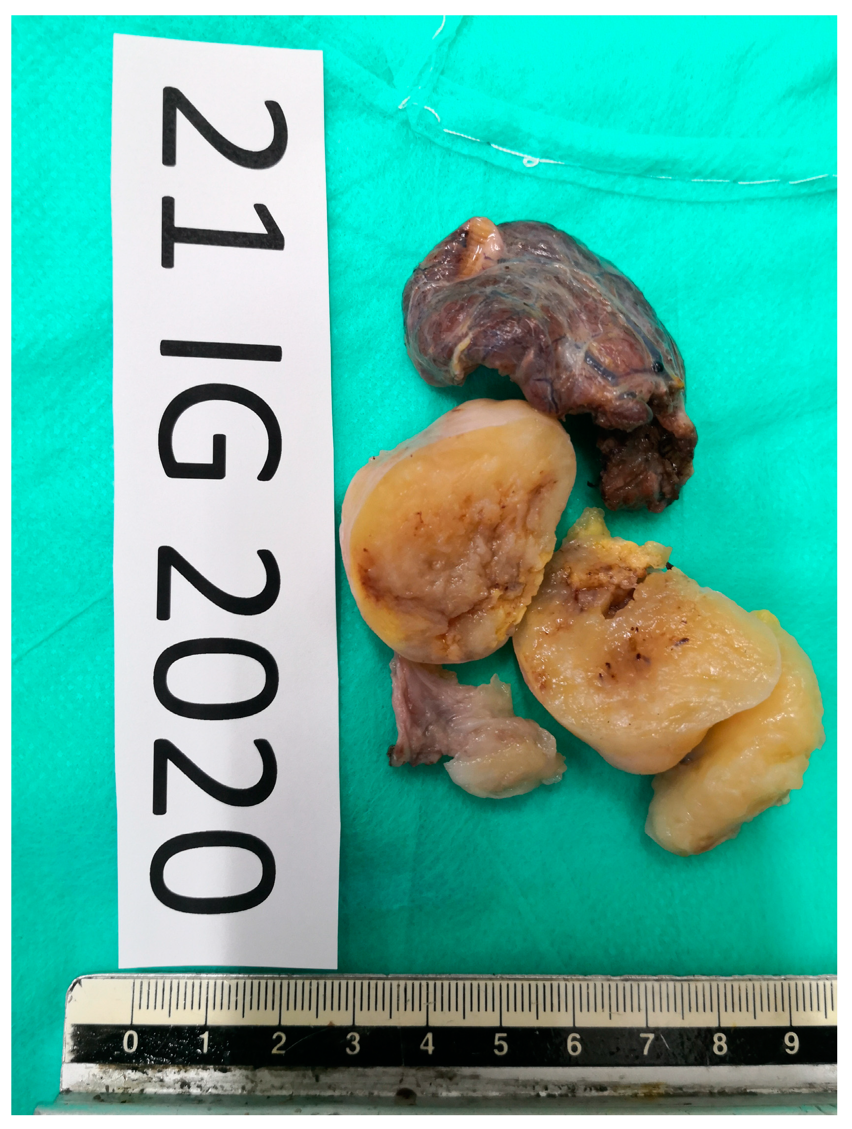 Medicina 58 01345 g005