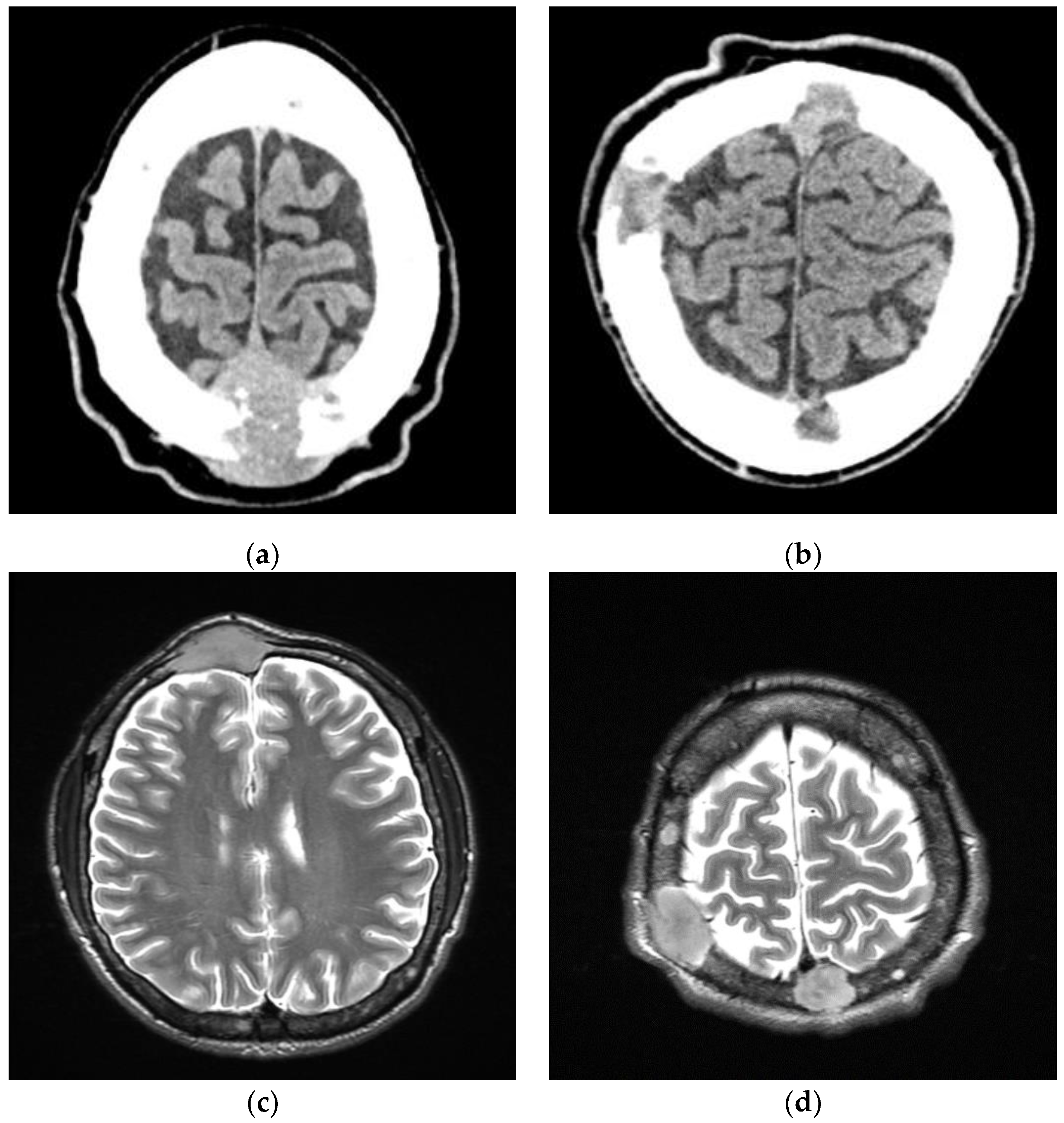 Medicina 58 01350 g001 Medicina 58 01350 g001