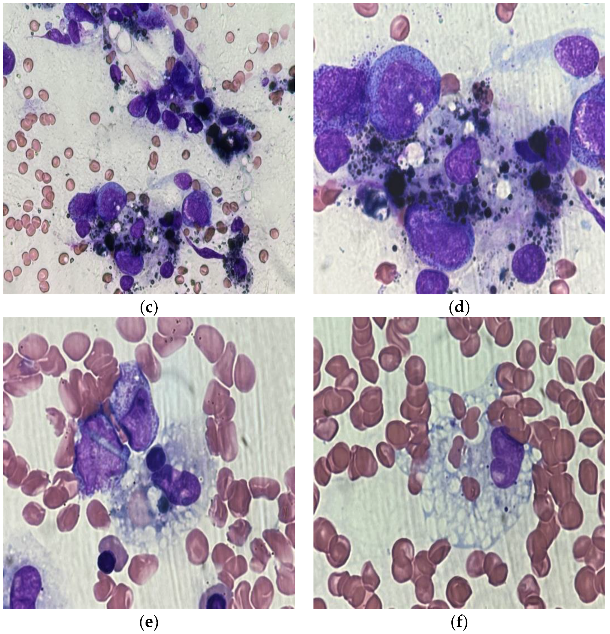 Medicina 58 01350 g003b Medicina 58 01350 g003b