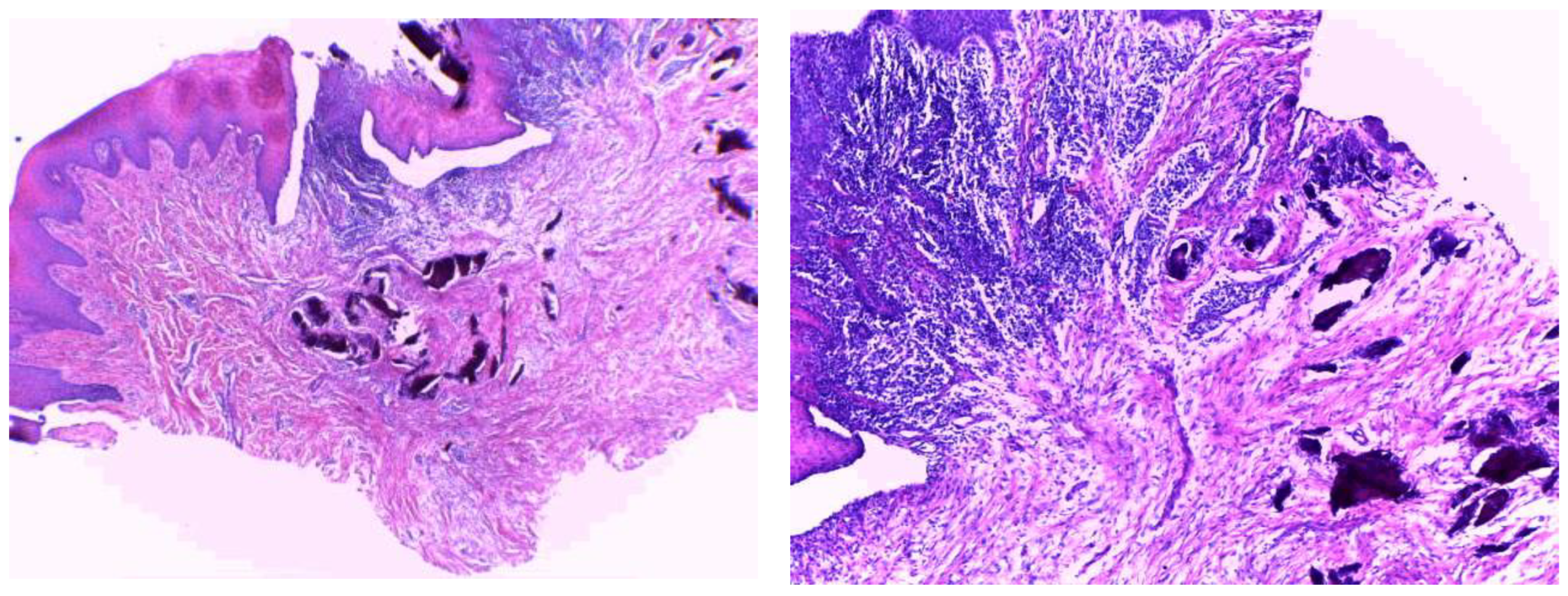 Medicina 58 01351 g003