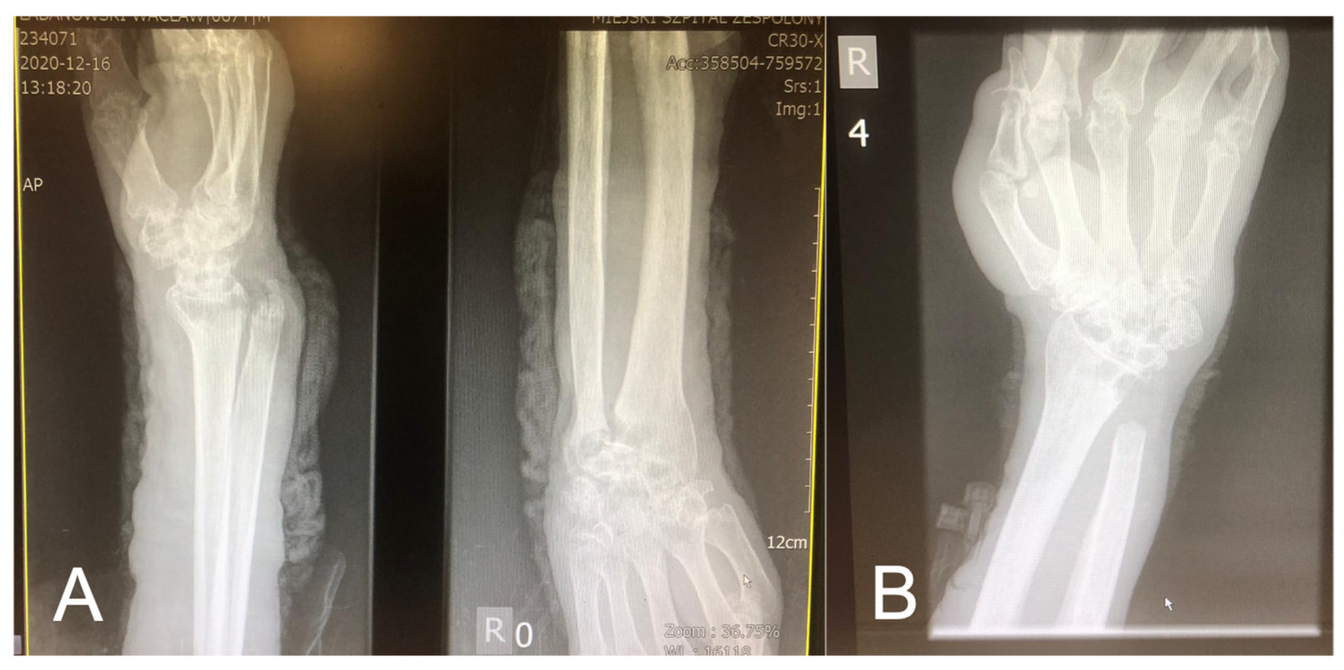 Medicina 58 01354 g005 550