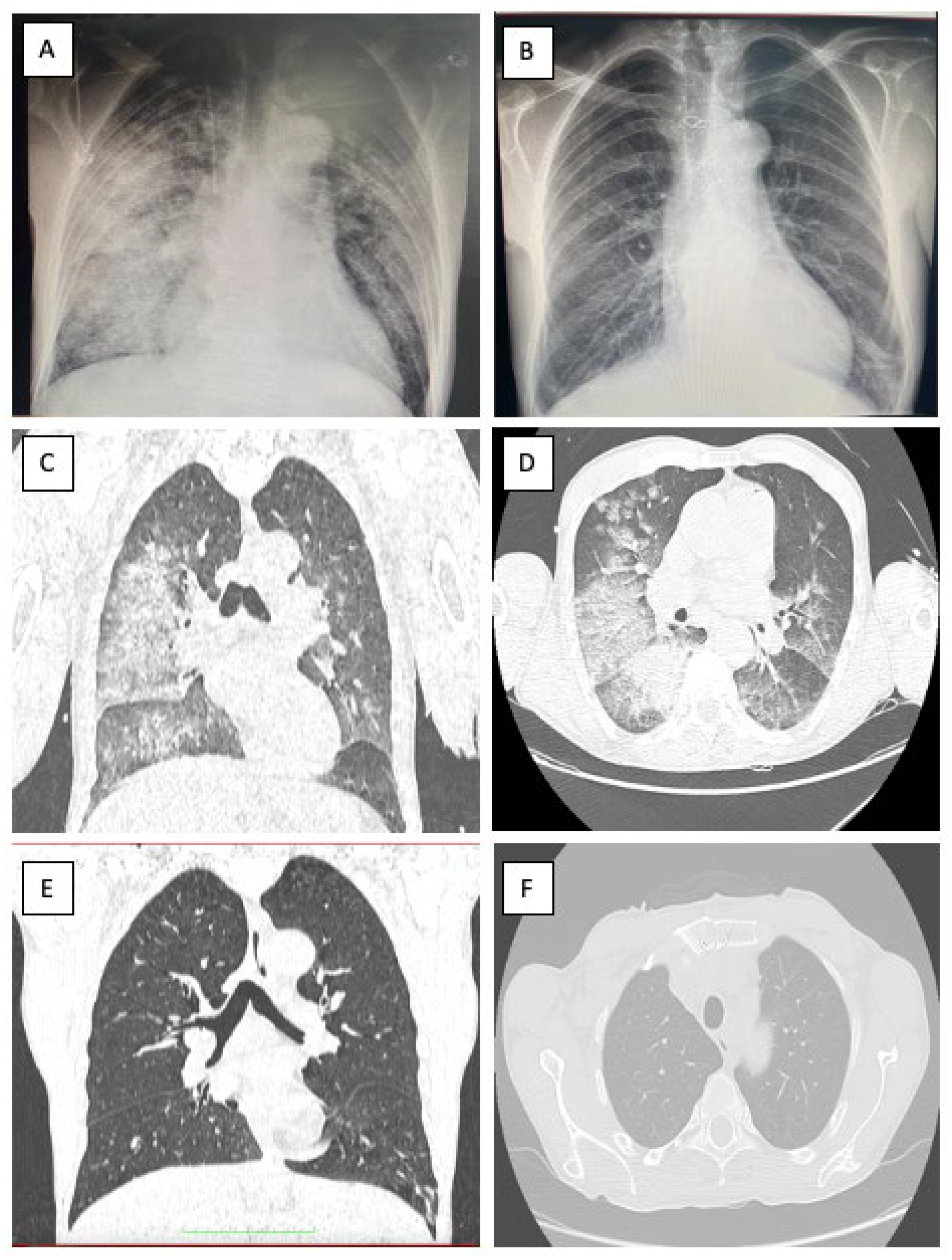 Medicina 58 01357 g001 Medicina 58 01357 g001