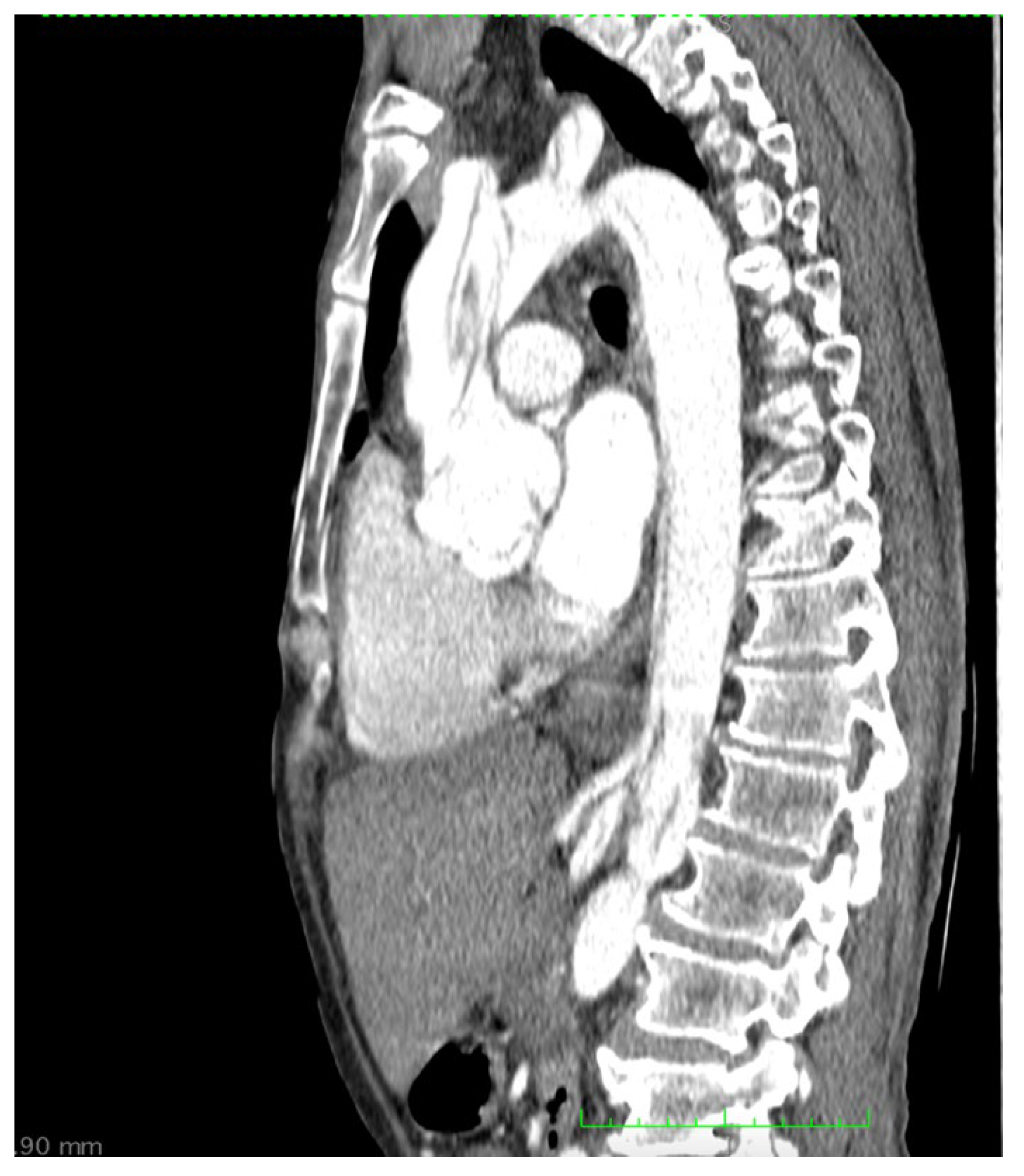 Medicina 58 01357 g002 Medicina 58 01357 g002