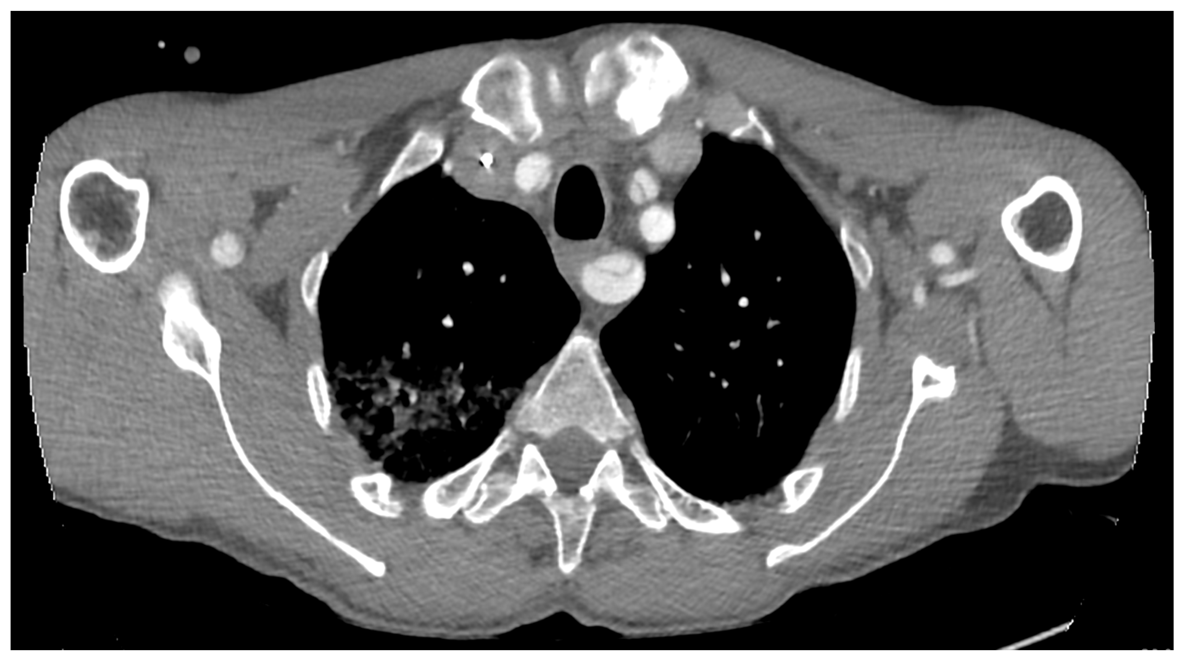 Medicina 58 01357 g004 Medicina 58 01357 g004