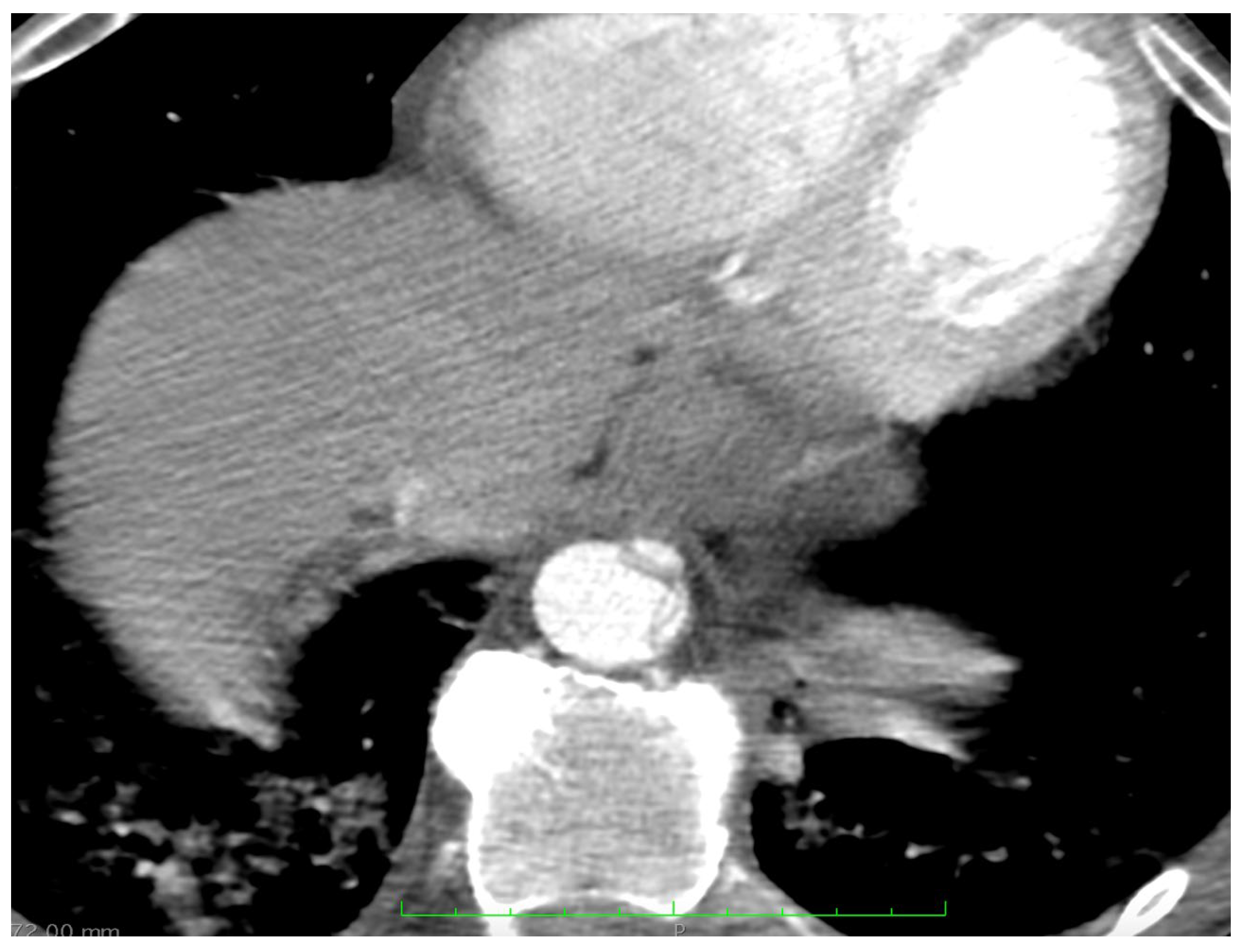 Medicina 58 01357 g005 Medicina 58 01357 g005