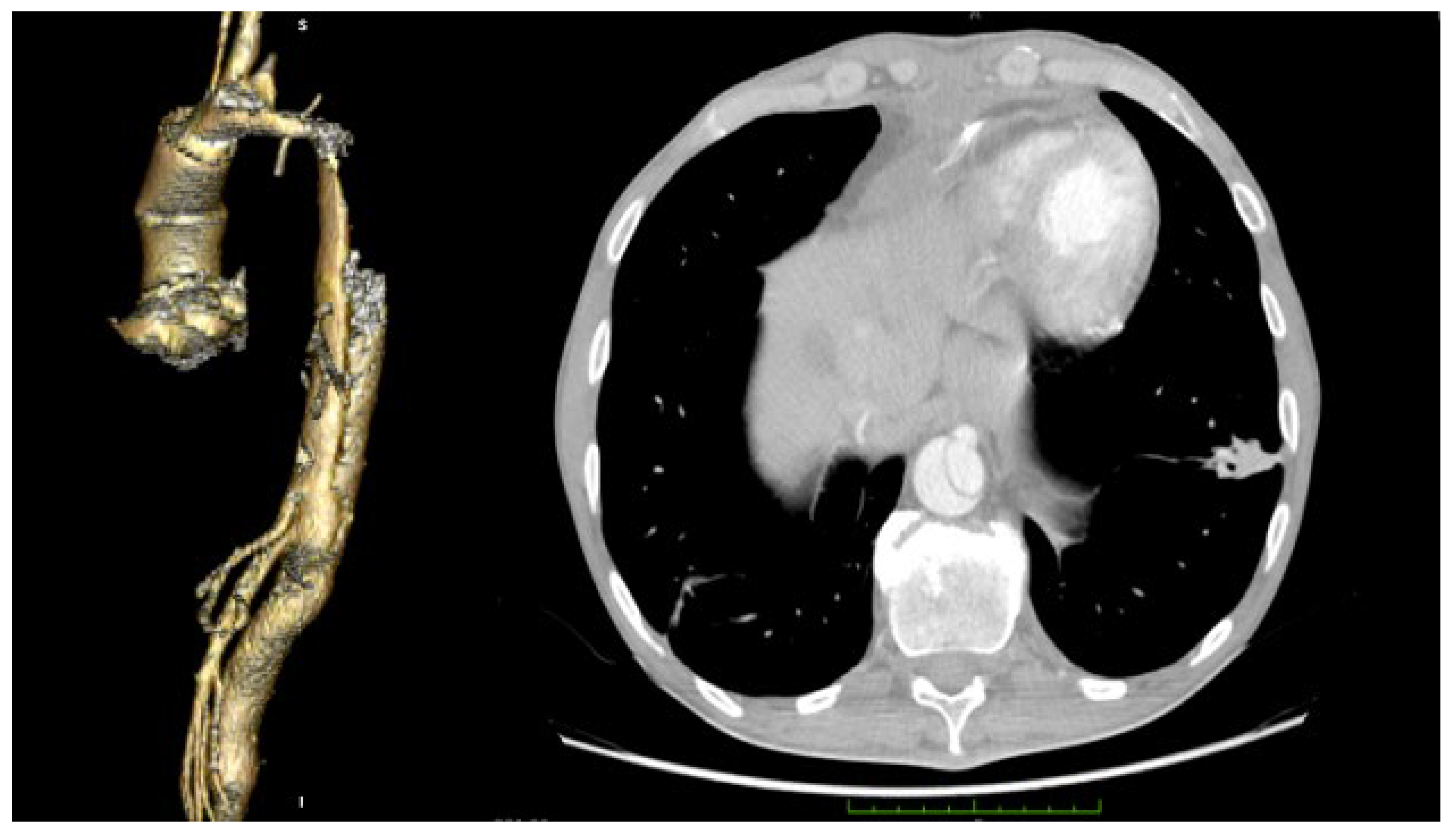 Medicina 58 01357 g006 Medicina 58 01357 g006