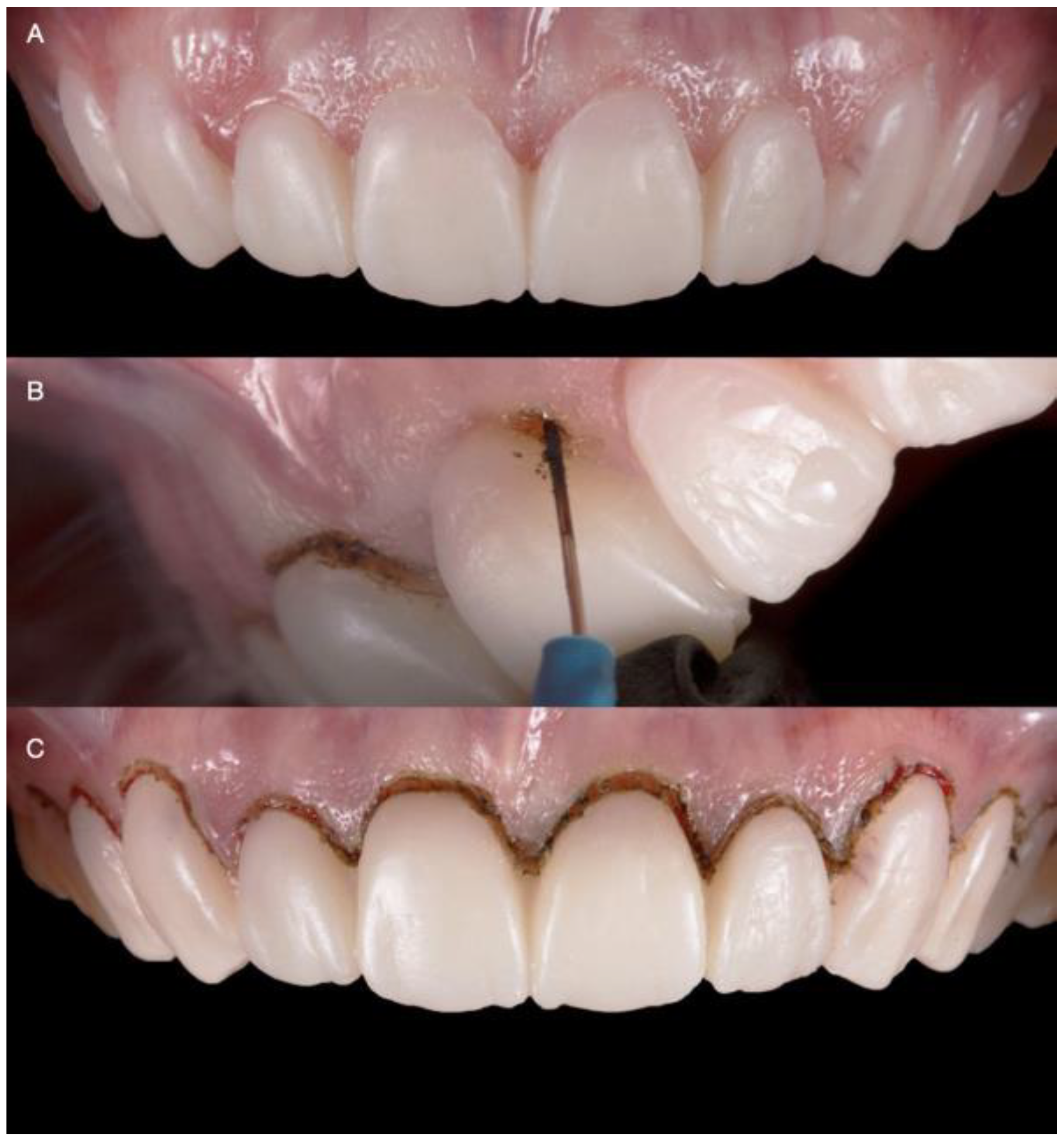 Medicina 58 01360 g003 550