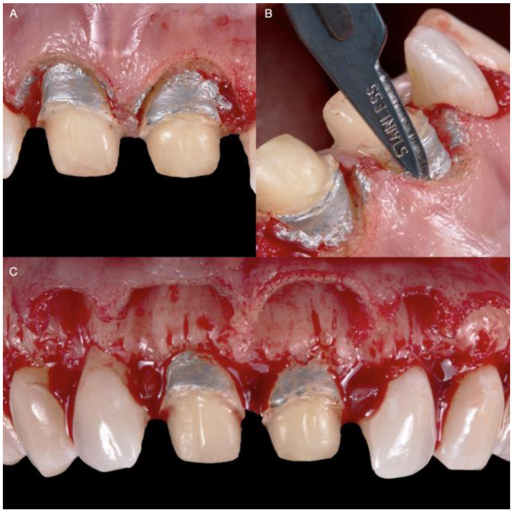 Medicina 58 01360 g005 550