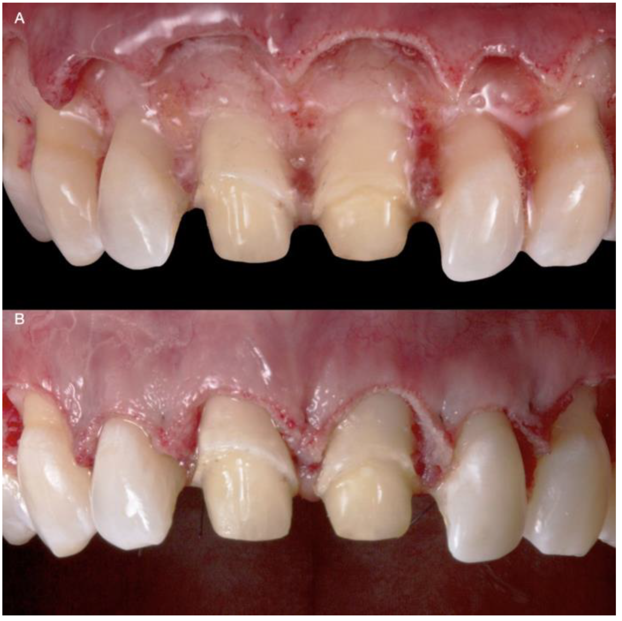 Medicina 58 01360 g006 550