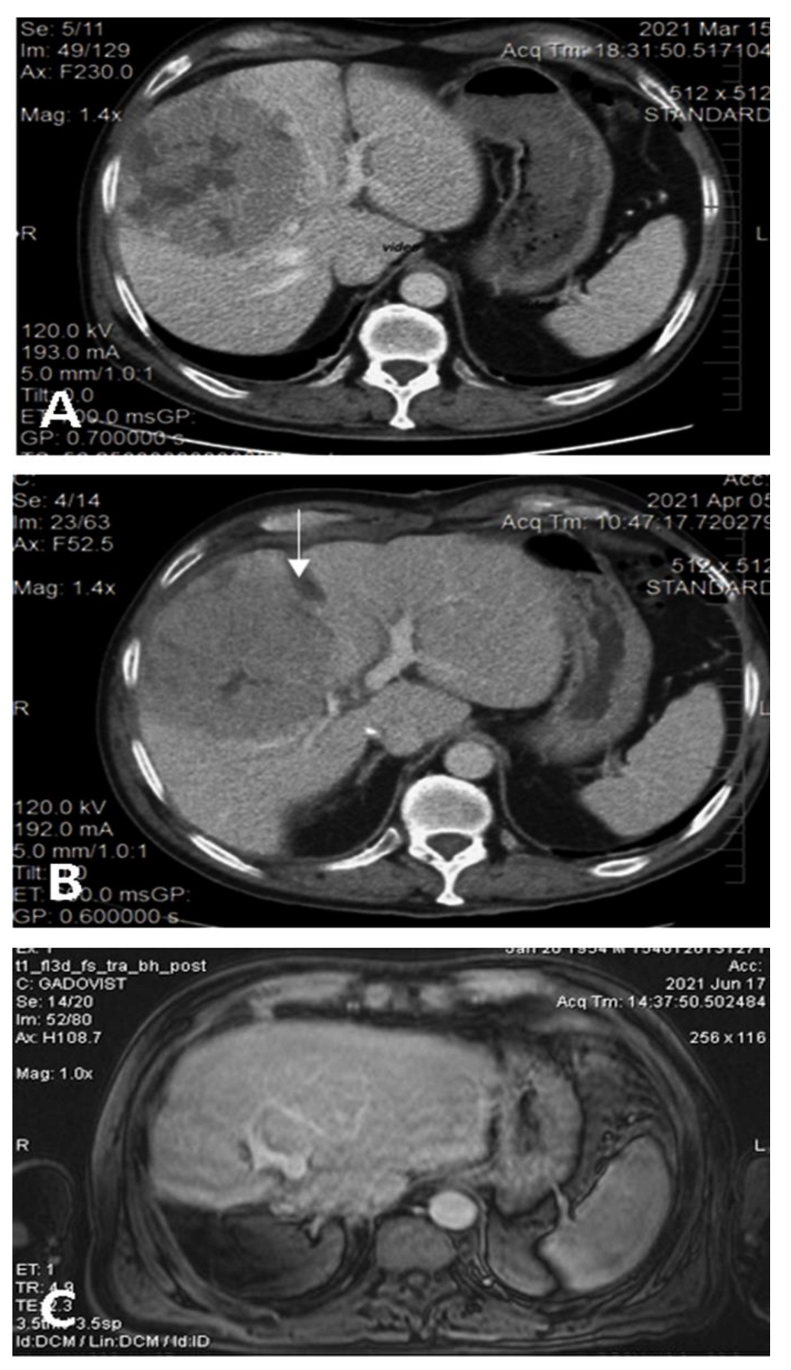 Medicina 58 01422 g002