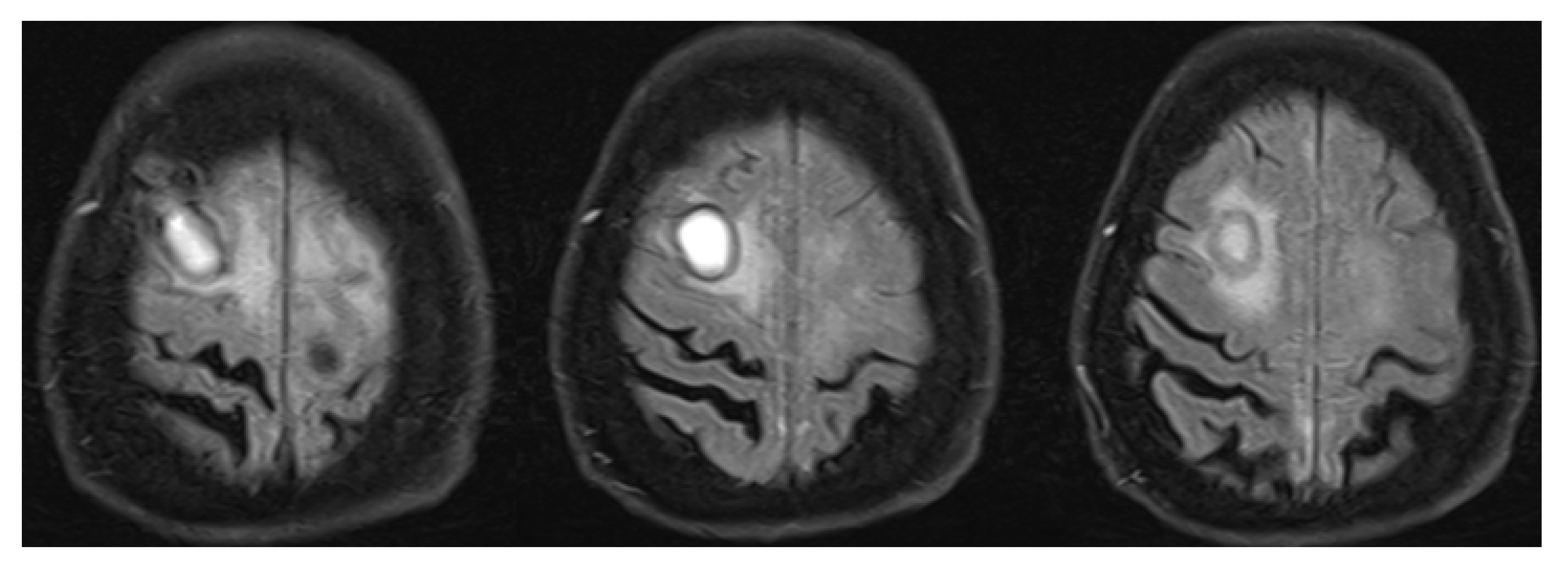 Medicina 58 01446 g003