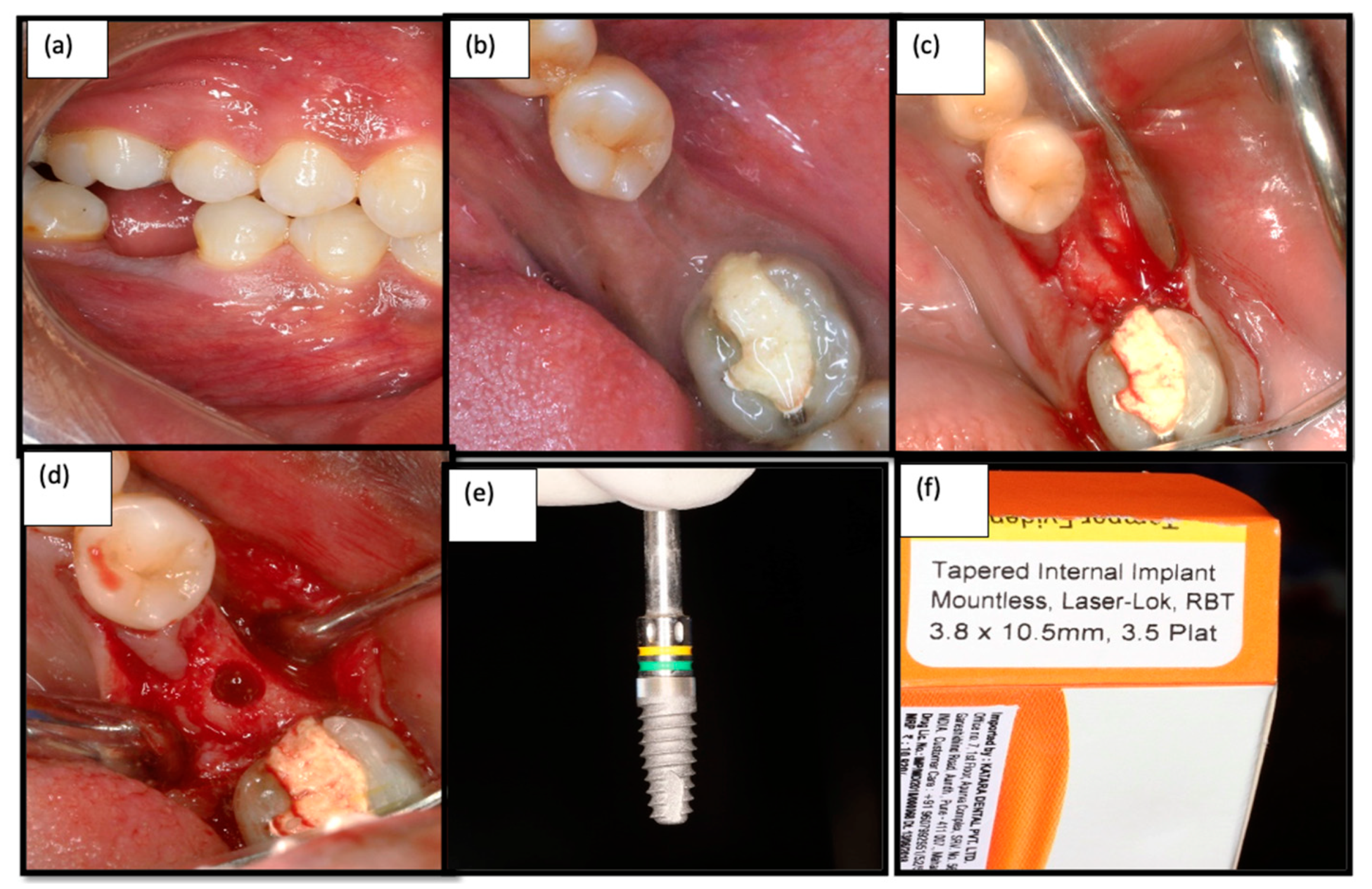 Medicina 58 01456 g002