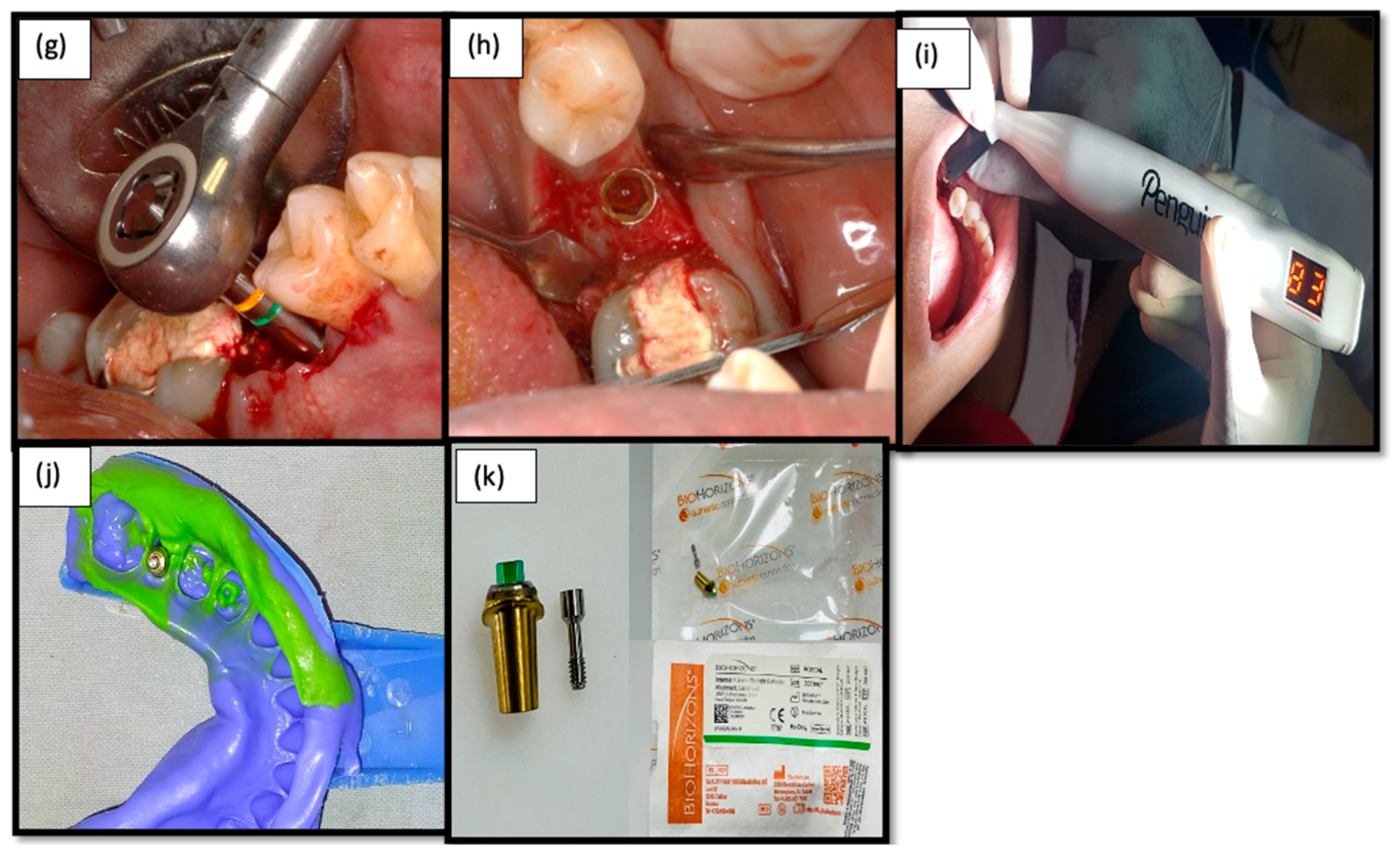 Medicina 58 01456 g003