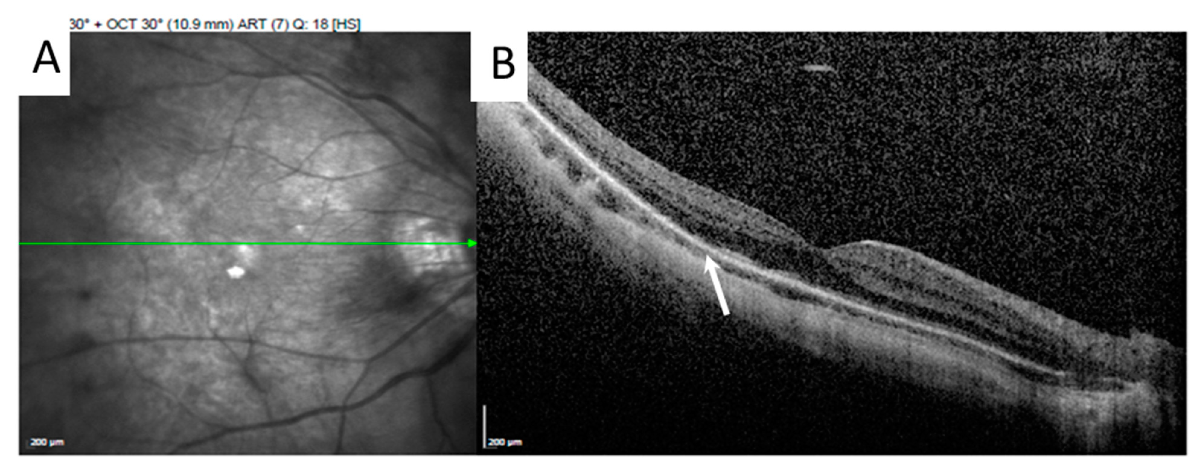 Medicina 58 01467 g004