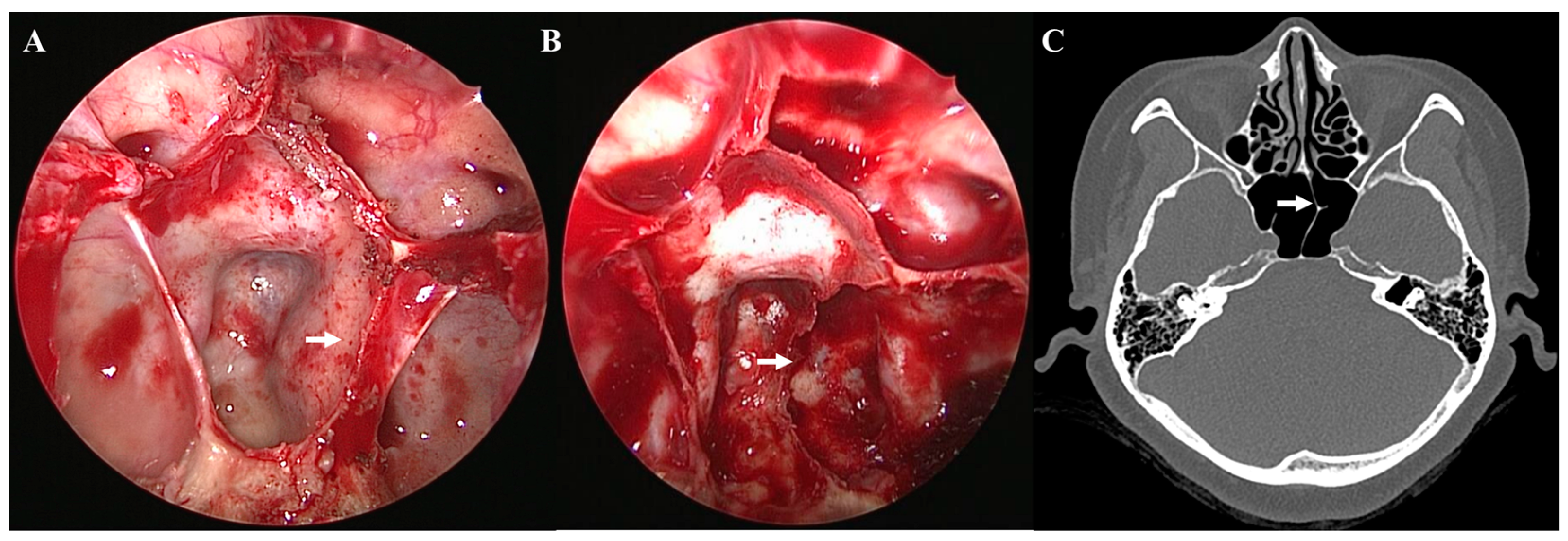 Medicina 58 01479 g001 Medicina 58 01479 g001