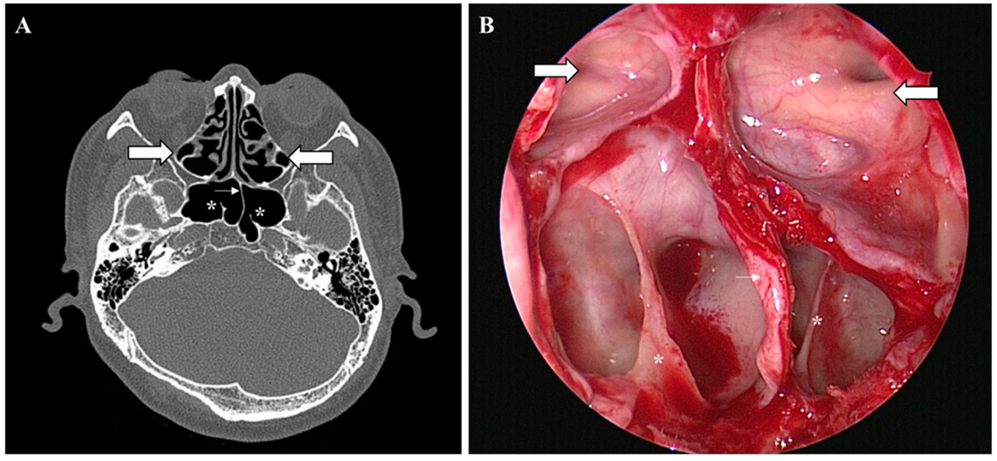 Medicina 58 01479 g003 Medicina 58 01479 g003