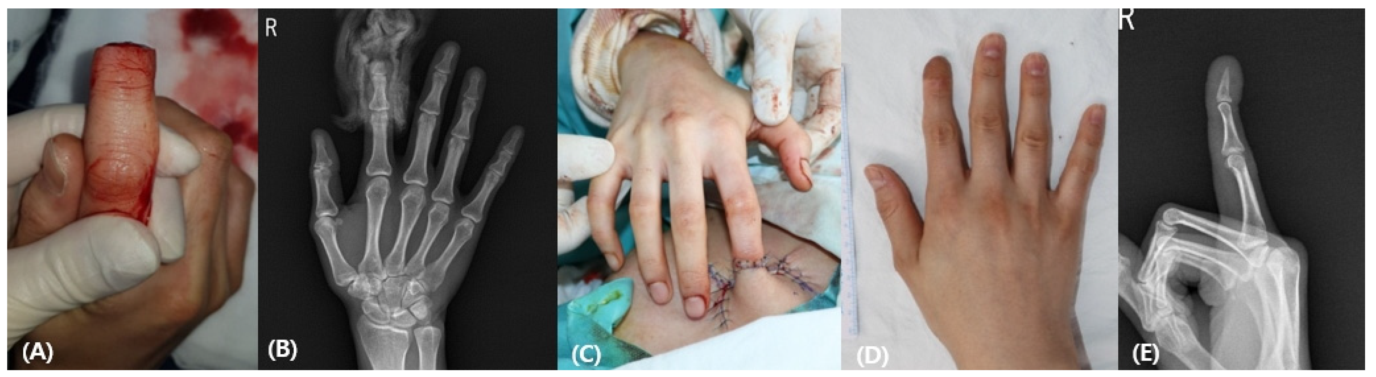 Medicina 58 01483 g003